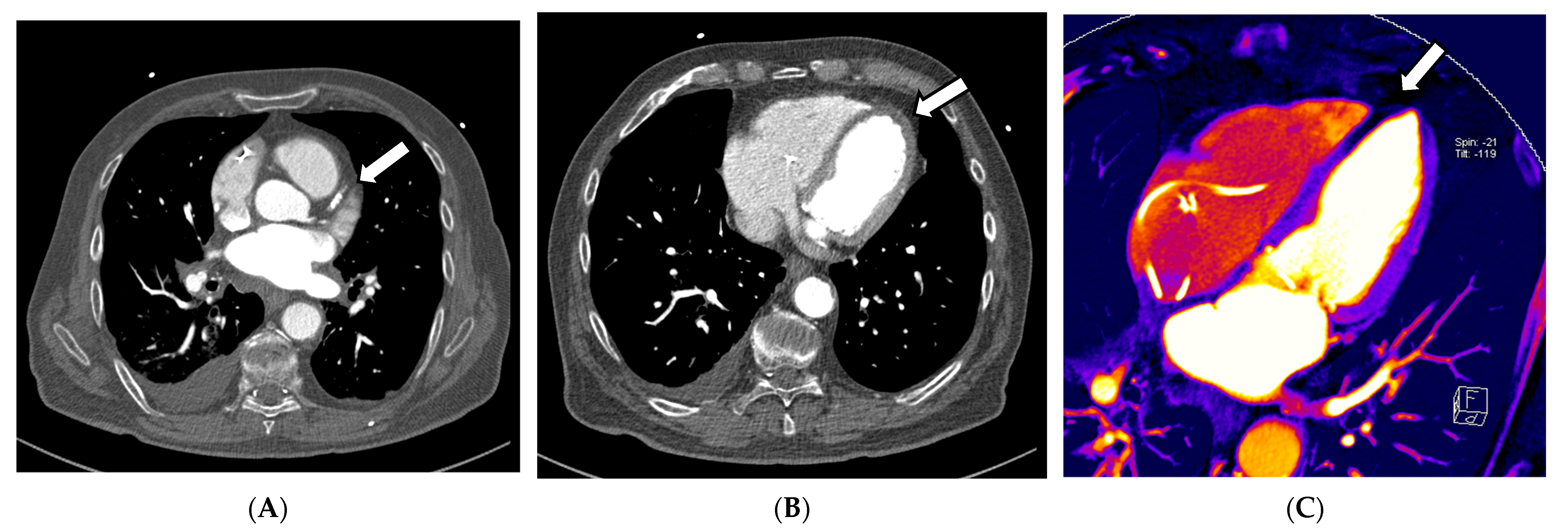 Diagnostics 13 02116 g003a