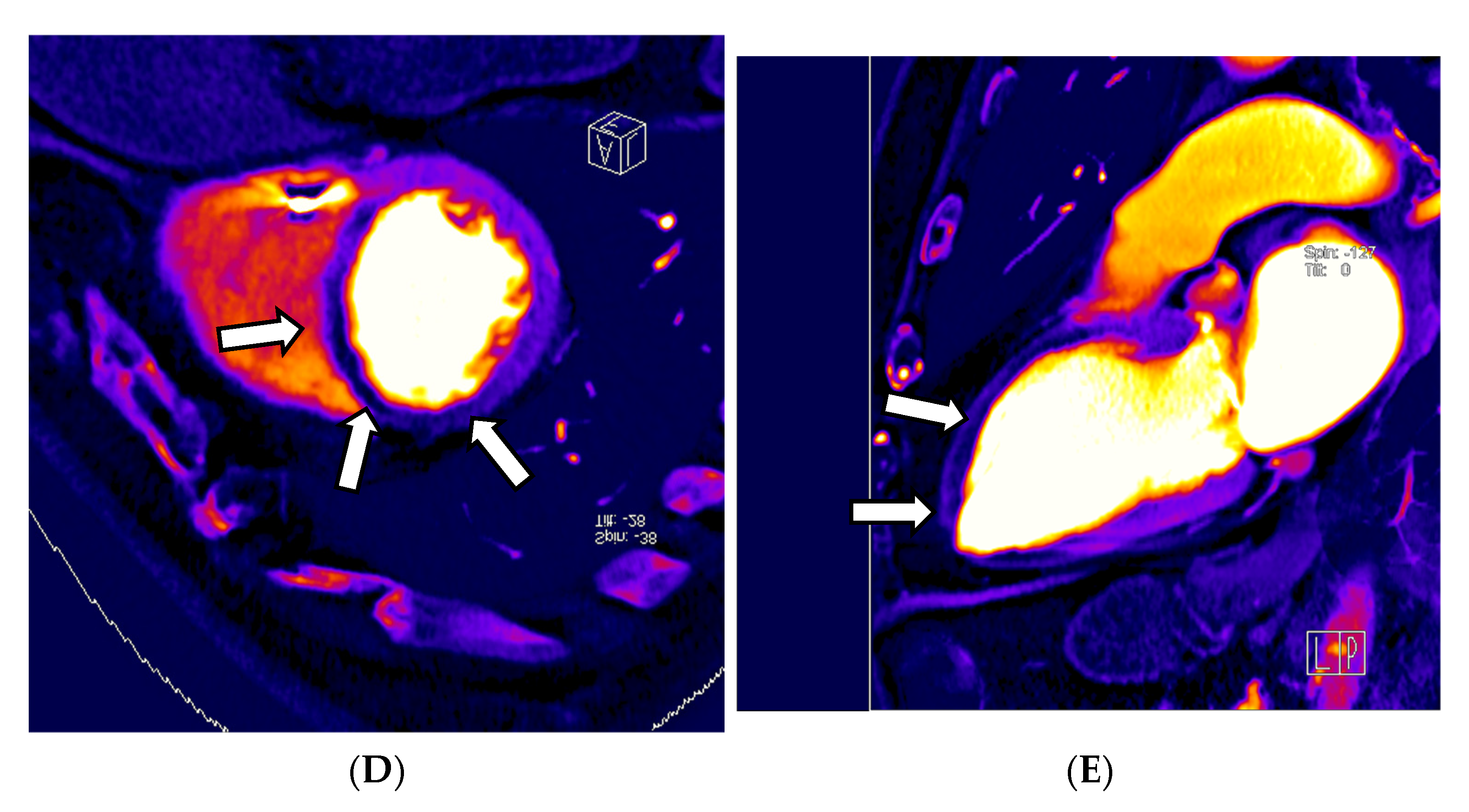 Diagnostics 13 02116 g003b
