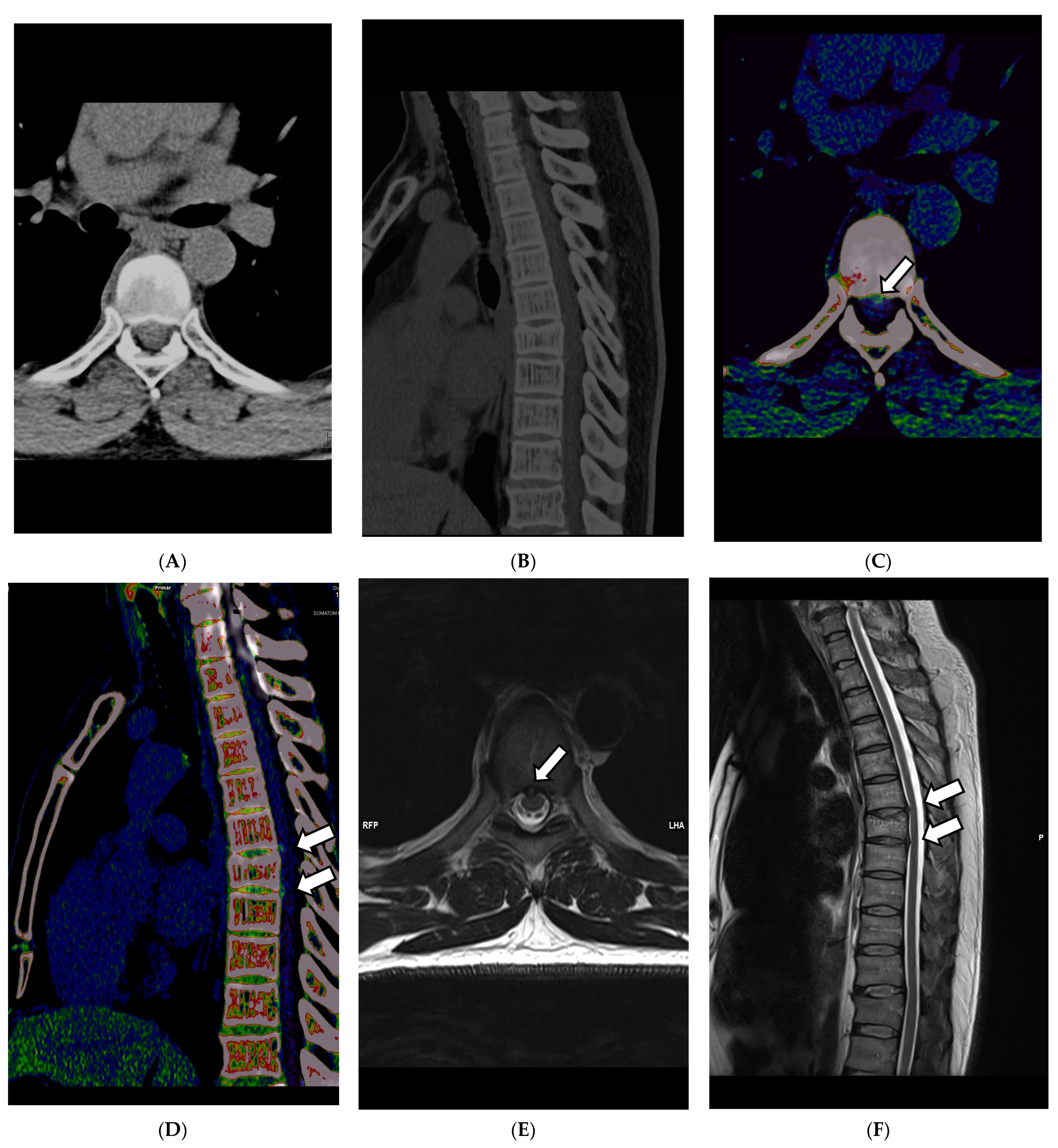 Diagnostics 13 02116 g004
