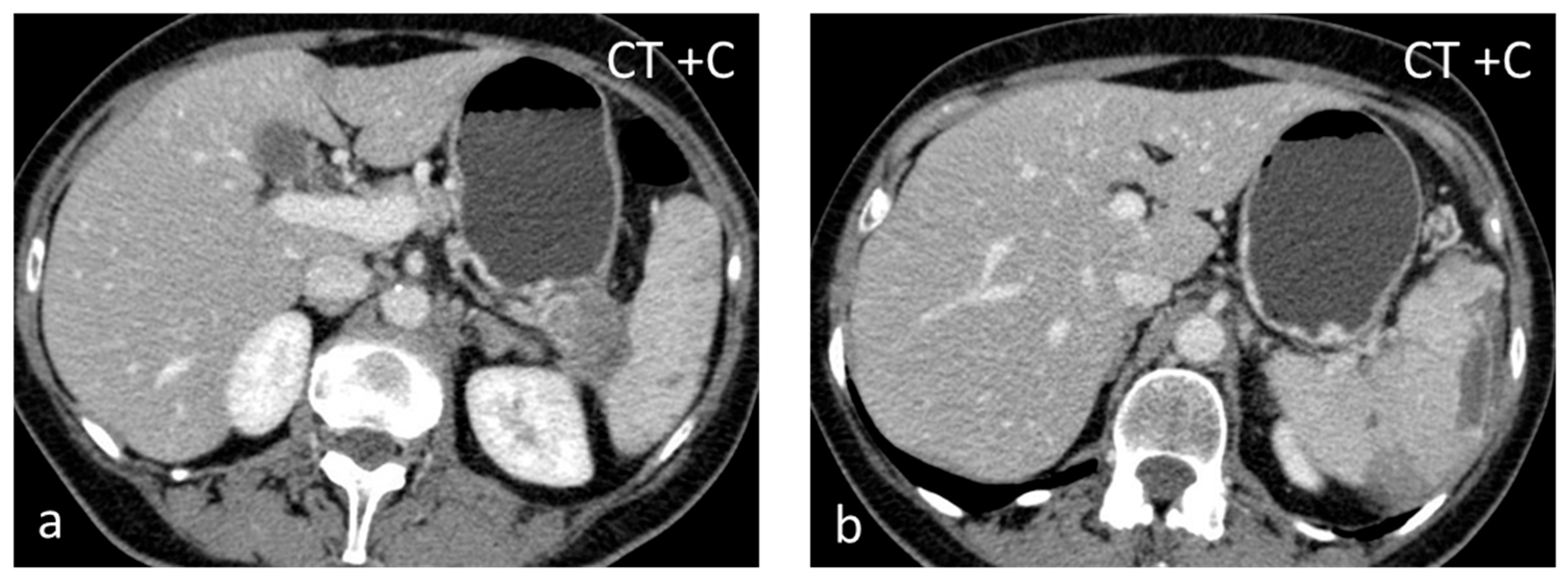 Diagnostics 13 02120 g005