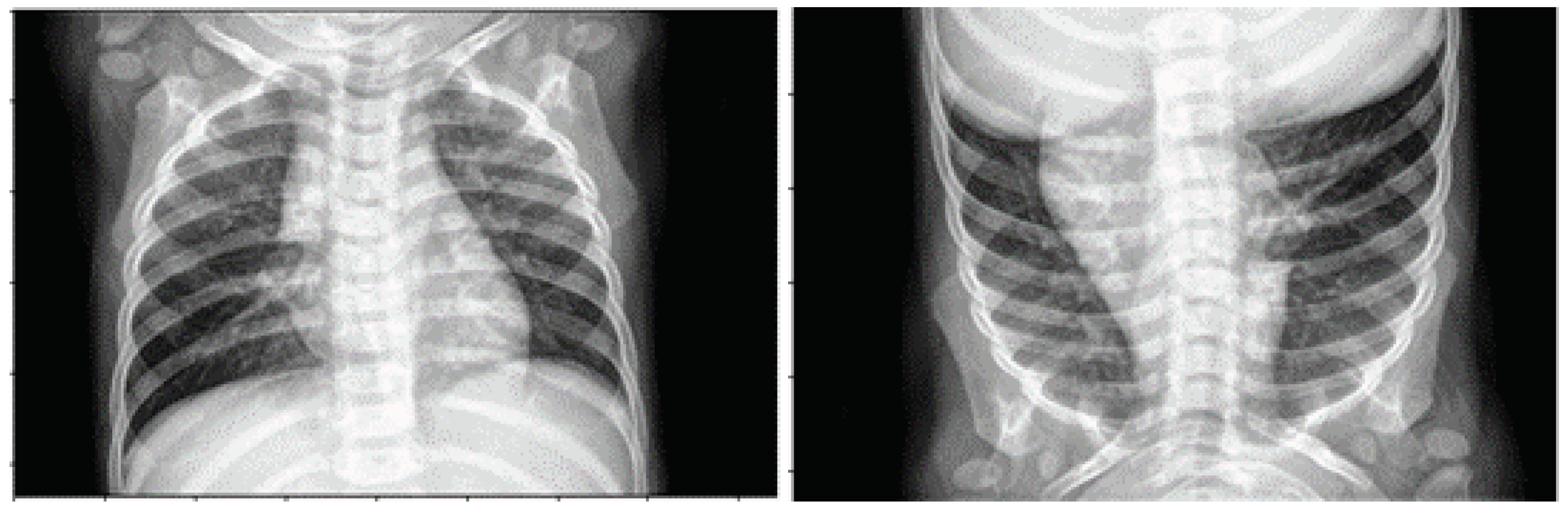 Diagnostics 13 02125 g003