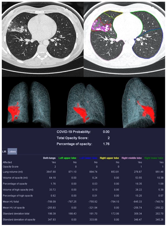 Diagnostics 13 02129 g004 Diagnostics 13 02129 g004