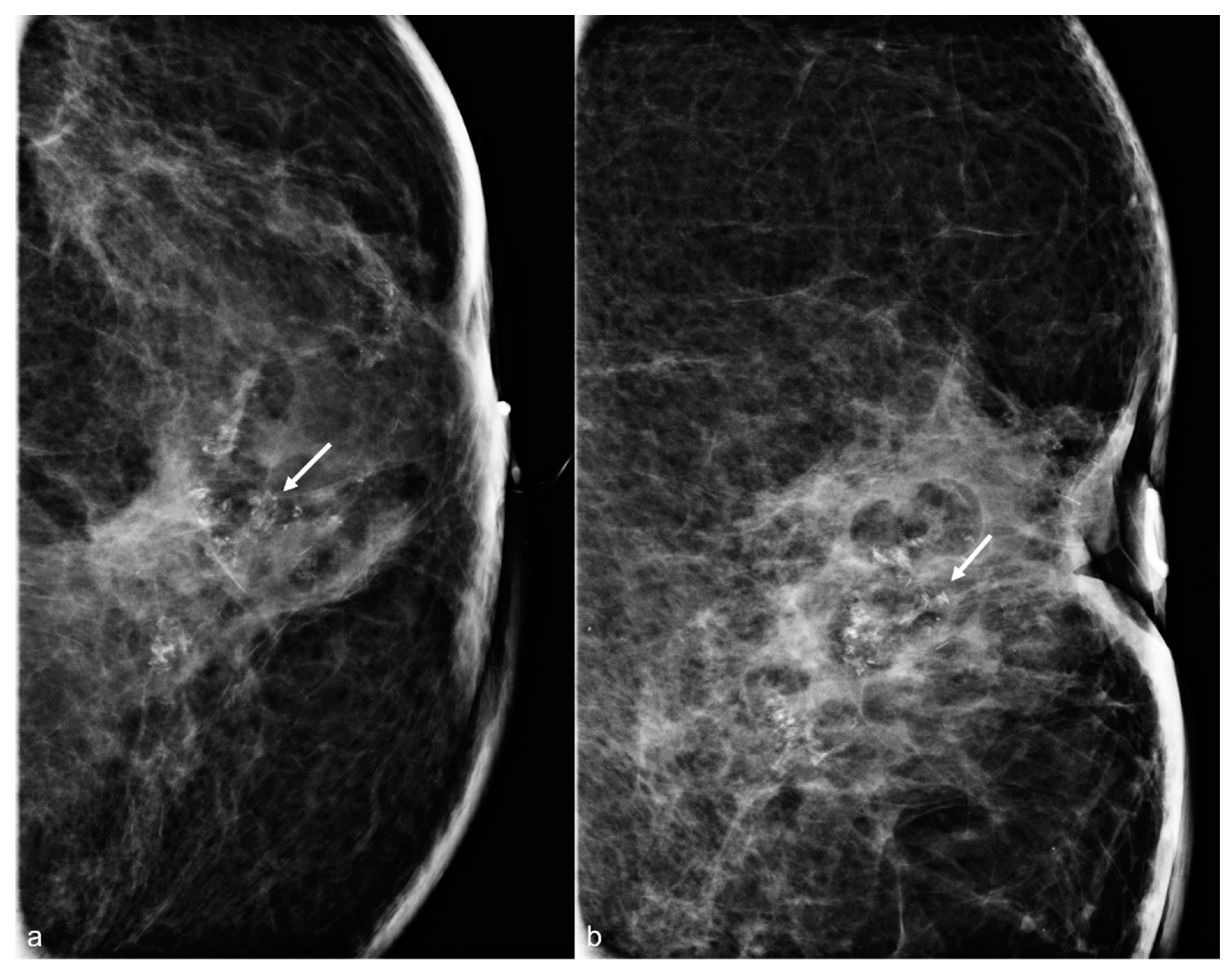 Diagnostics 13 02173 g004