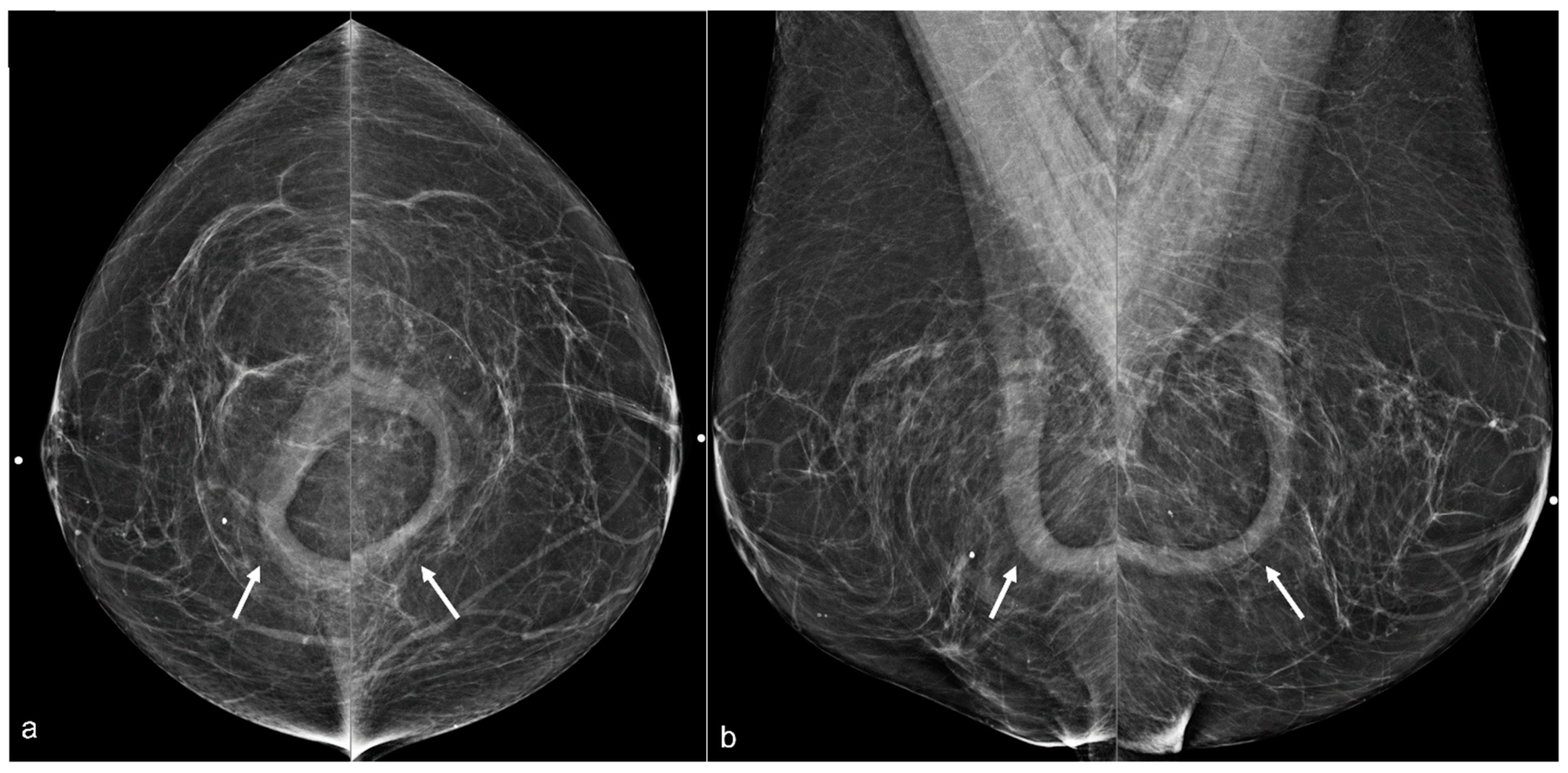 Diagnostics 13 02173 g011