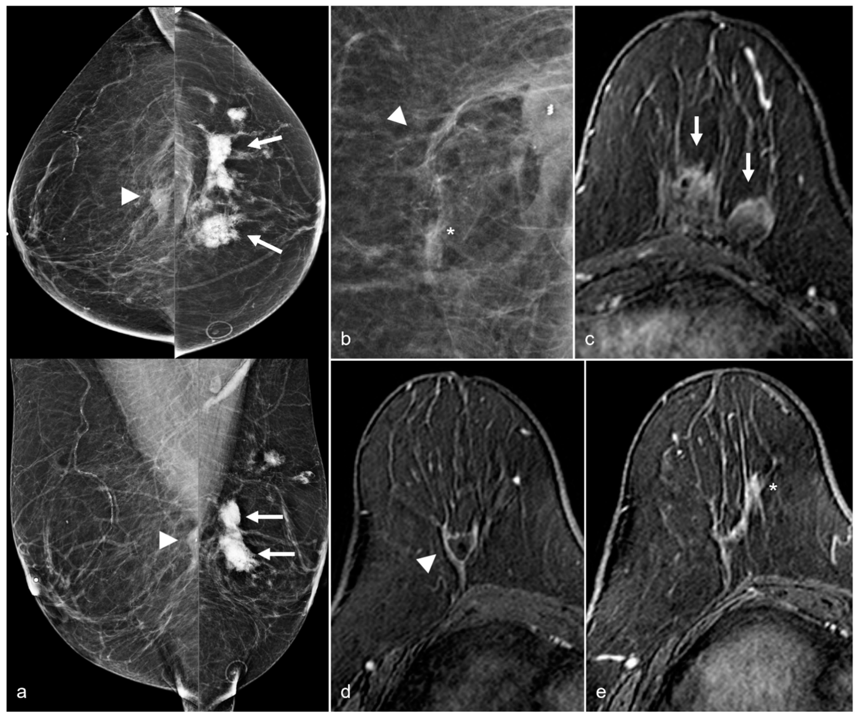 Diagnostics 13 02173 g014