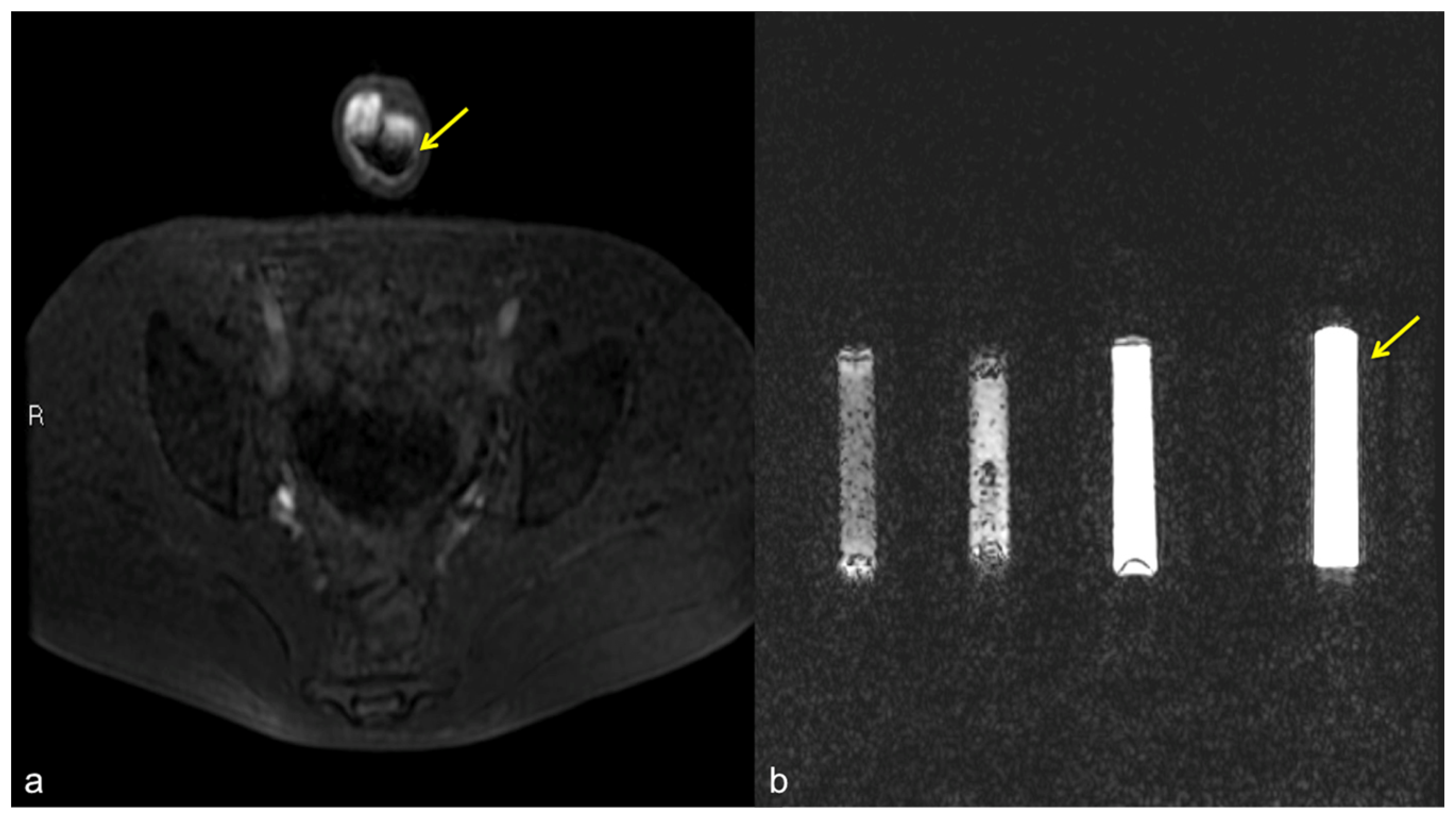 Diagnostics 13 02178 g011