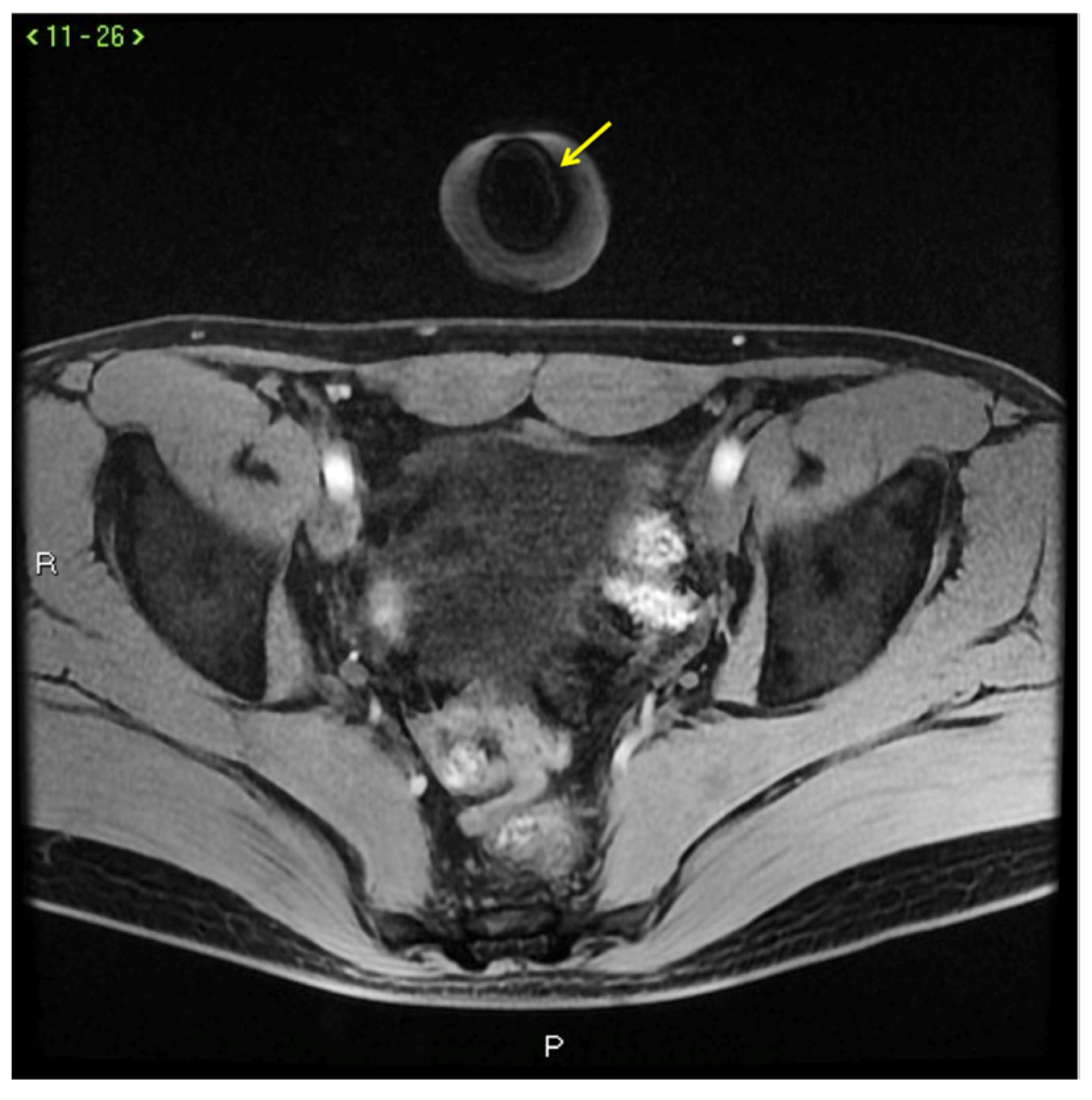 Diagnostics 13 02178 g012