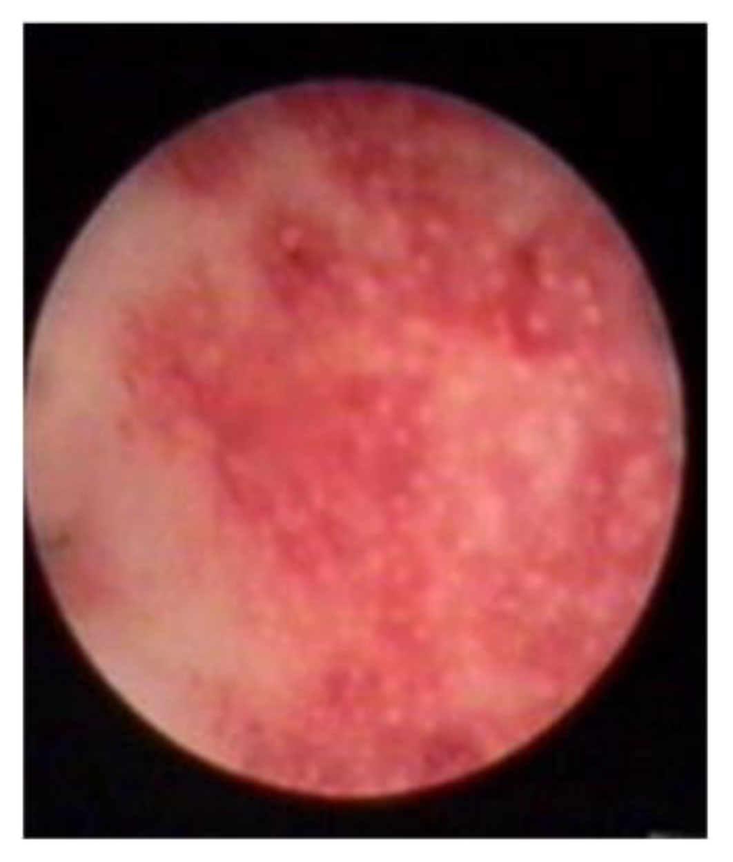 Diagnostics 13 02182 g003