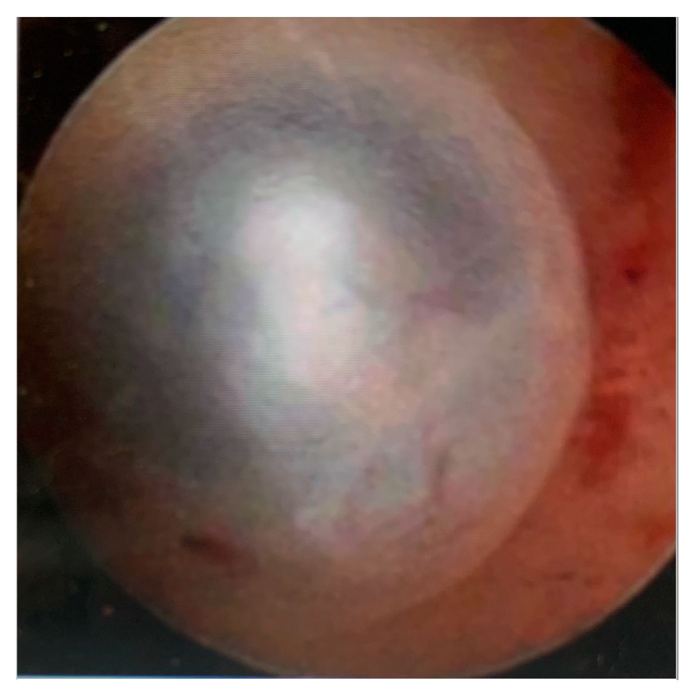 Diagnostics 13 02182 g005