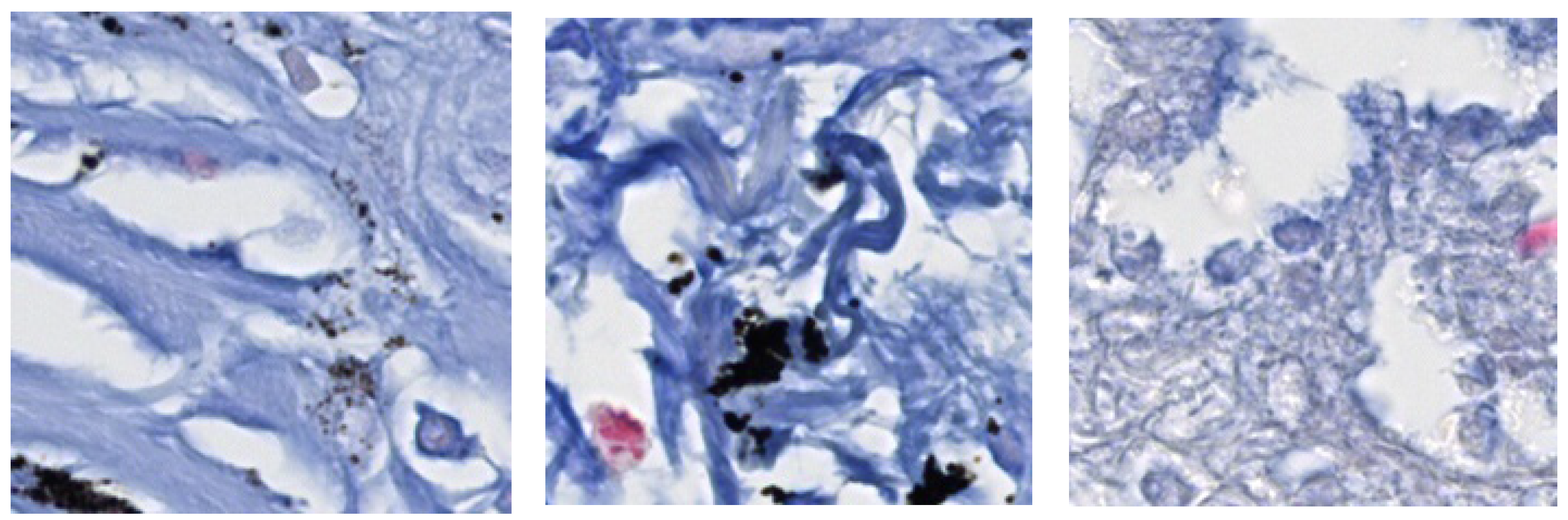 Diagnostics 13 02230 g008 Diagnostics 13 02230 g008