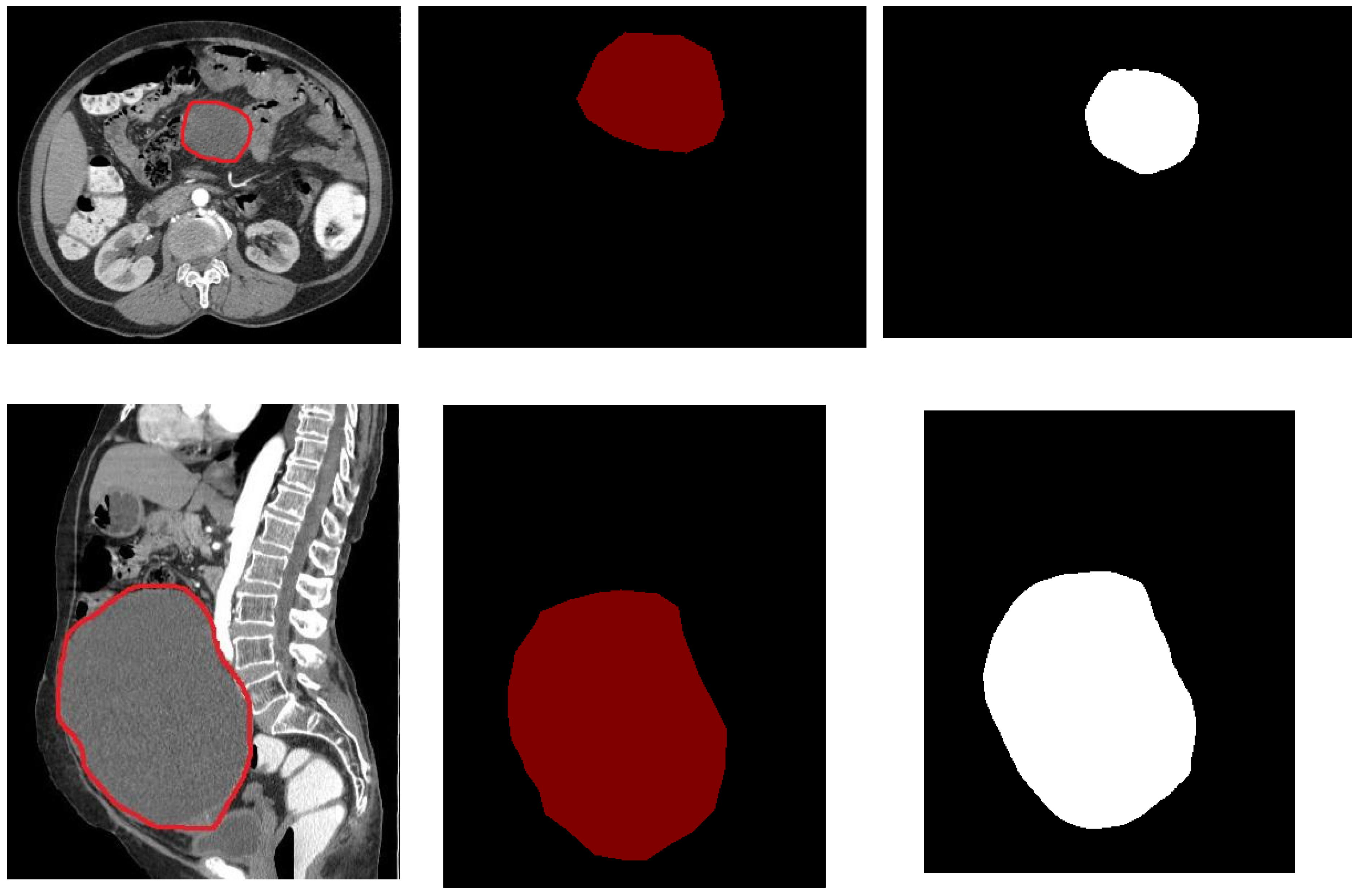Diagnostics 13 02282 g003b