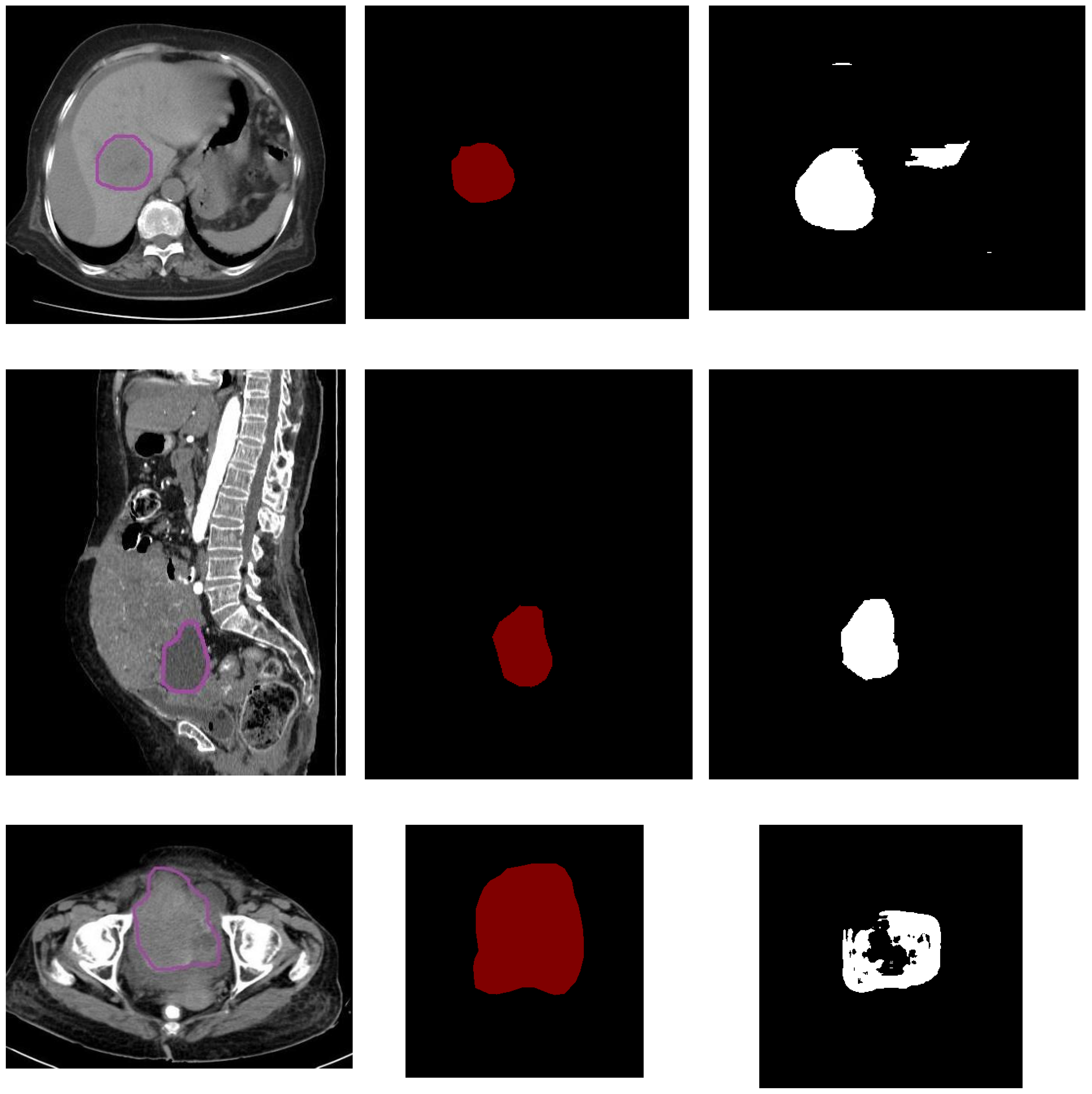 Diagnostics 13 02282 g004