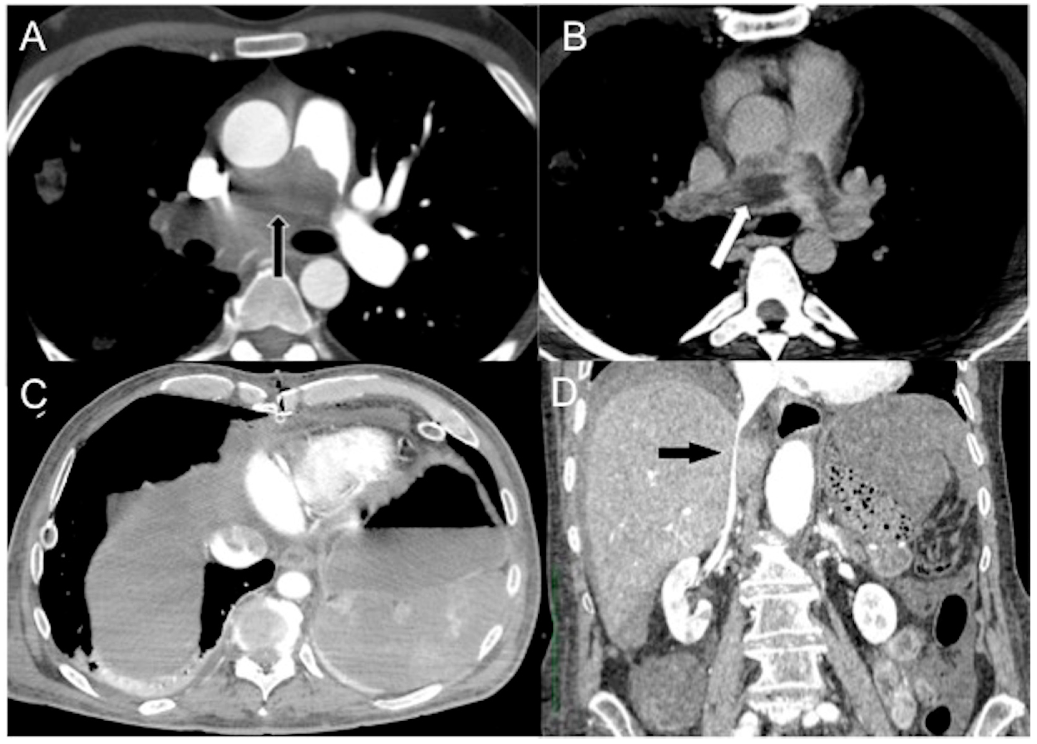 Diagnostics 13 02304 g004