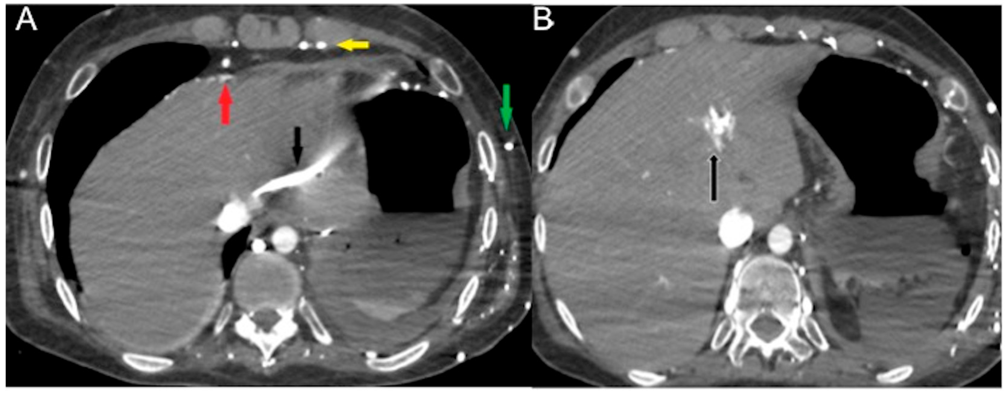 Diagnostics 13 02304 g005