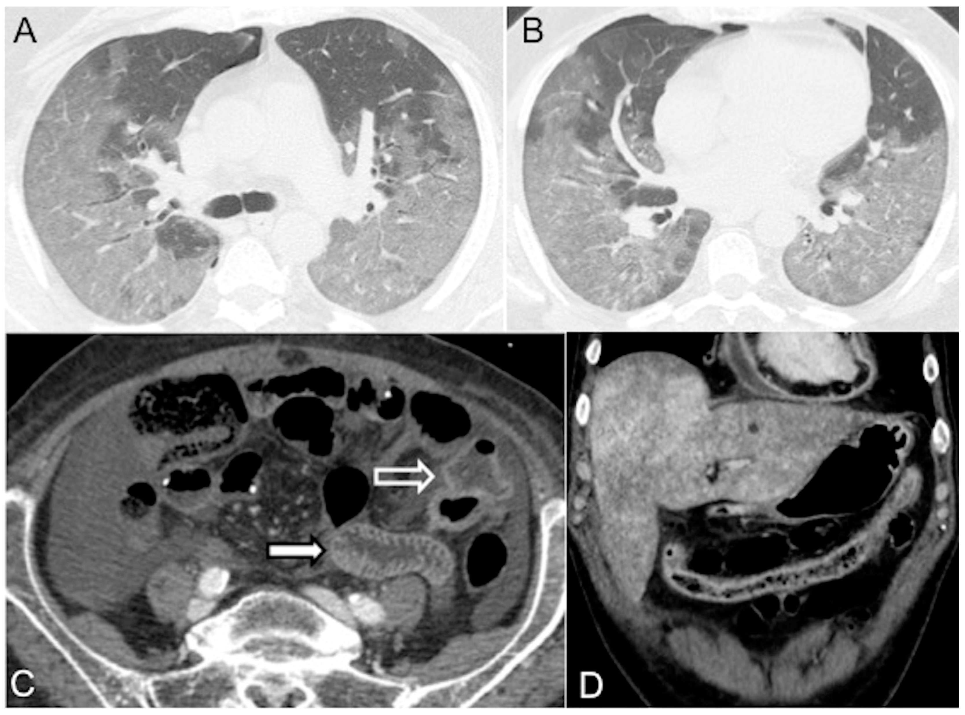 Diagnostics 13 02304 g006