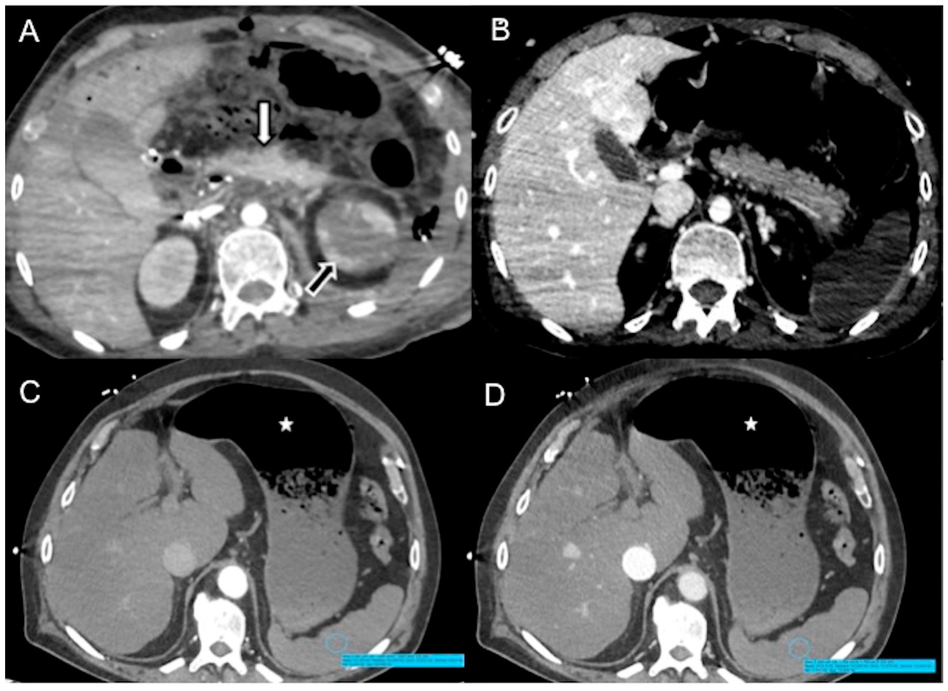 Diagnostics 13 02304 g008