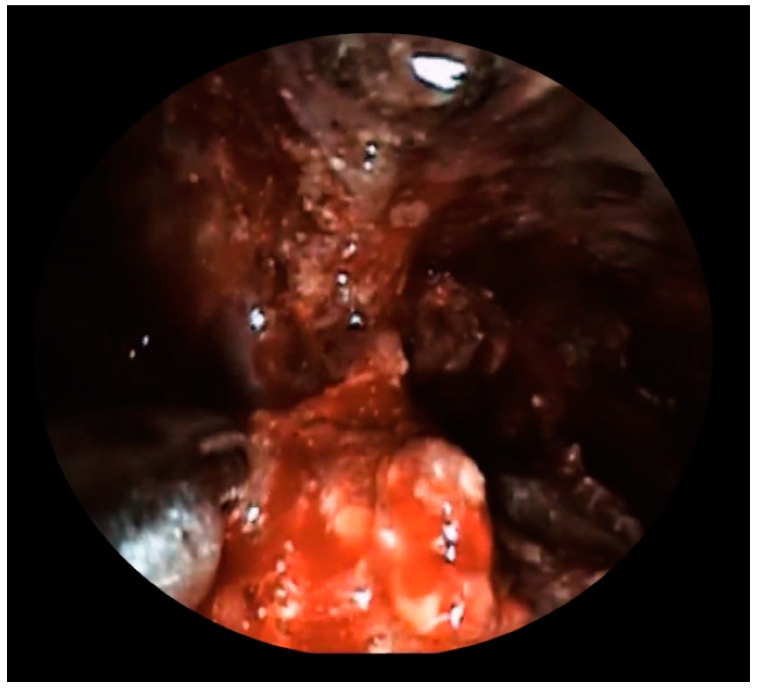 Diagnostics 13 02321 g003 Diagnostics 13 02321 g003