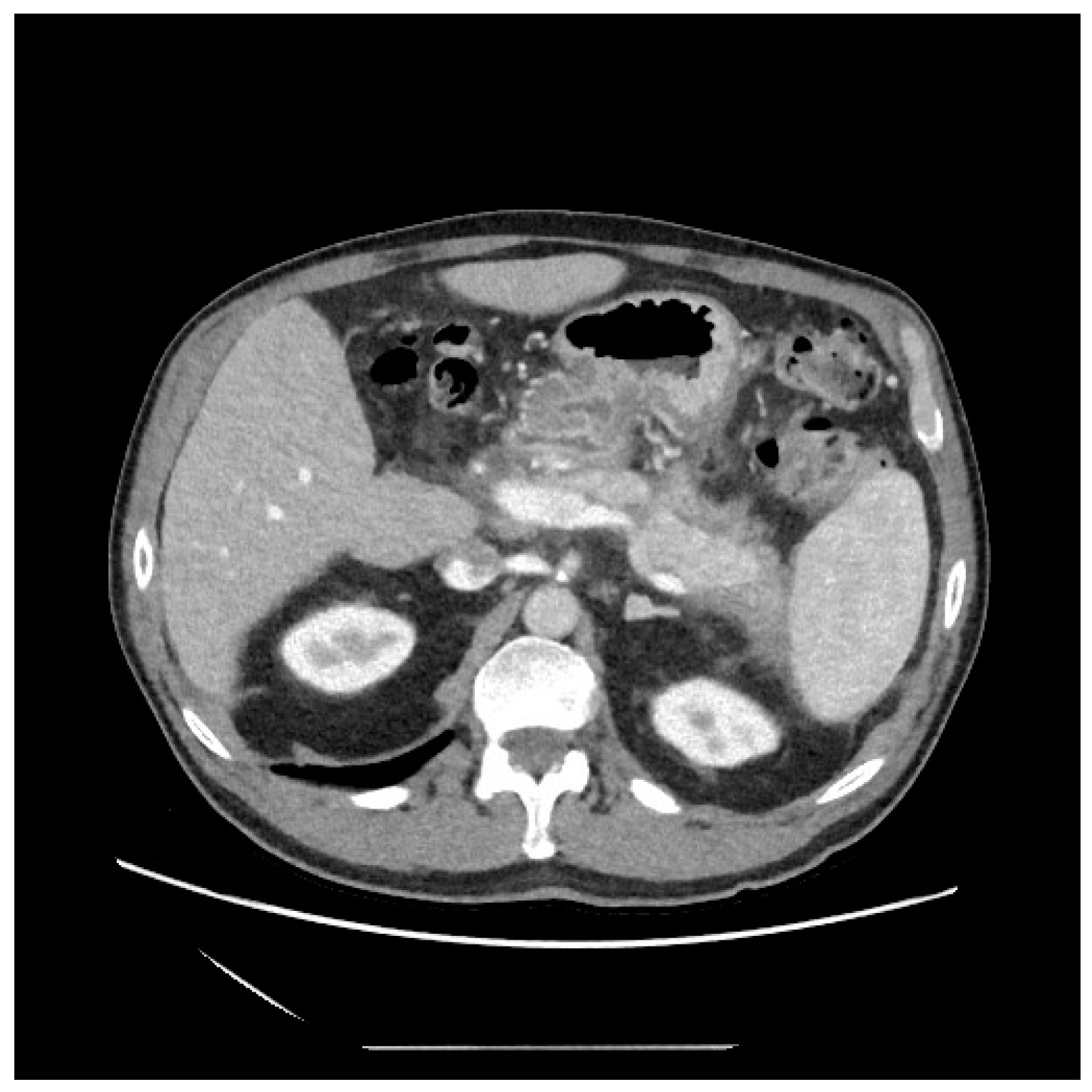 Diagnostics 13 02321 g004 Diagnostics 13 02321 g004