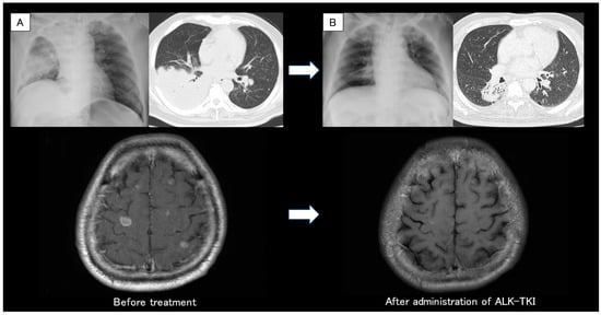 Diagnostics 13 02327 g001 550