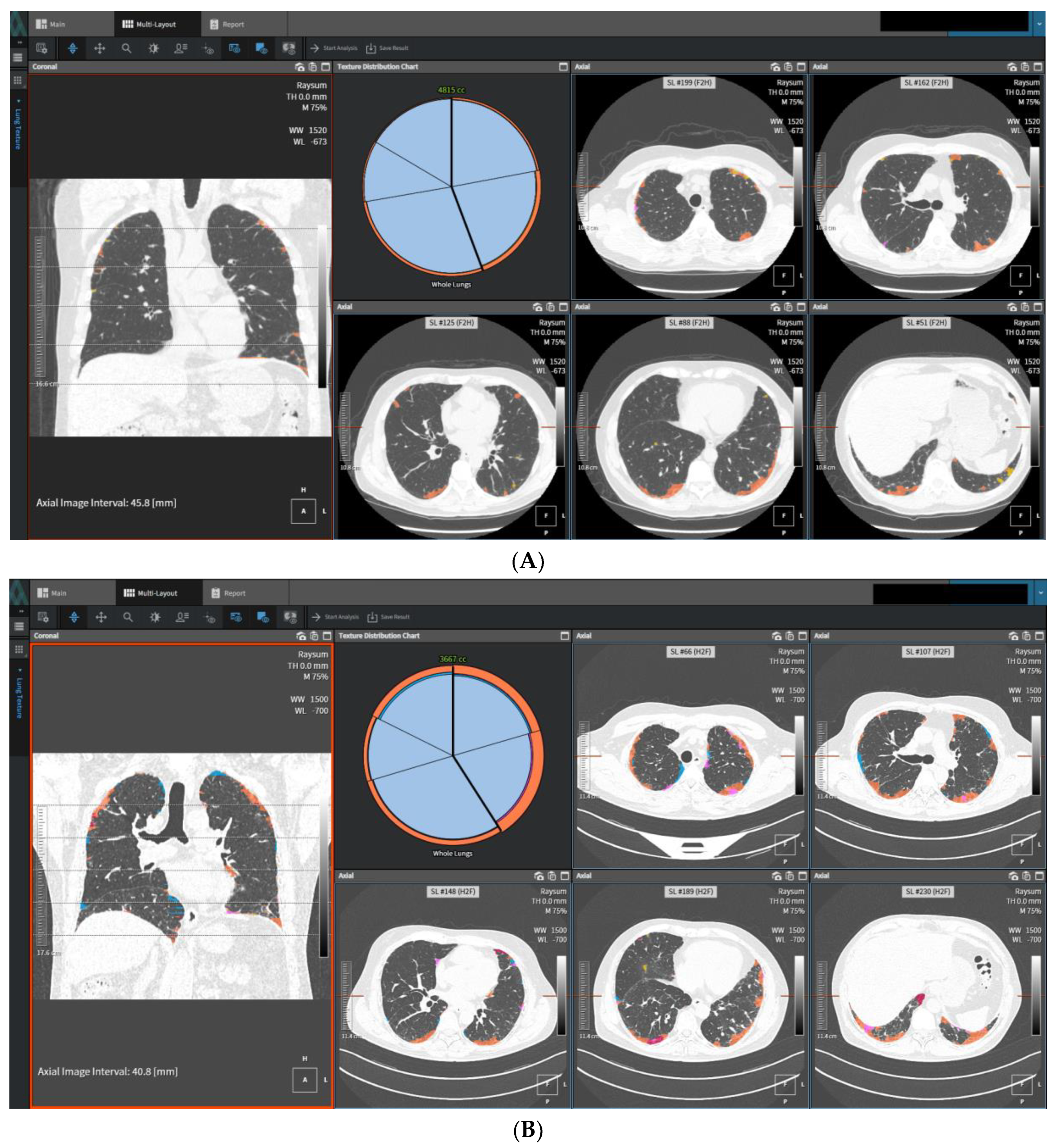 Diagnostics 13 02333 g003