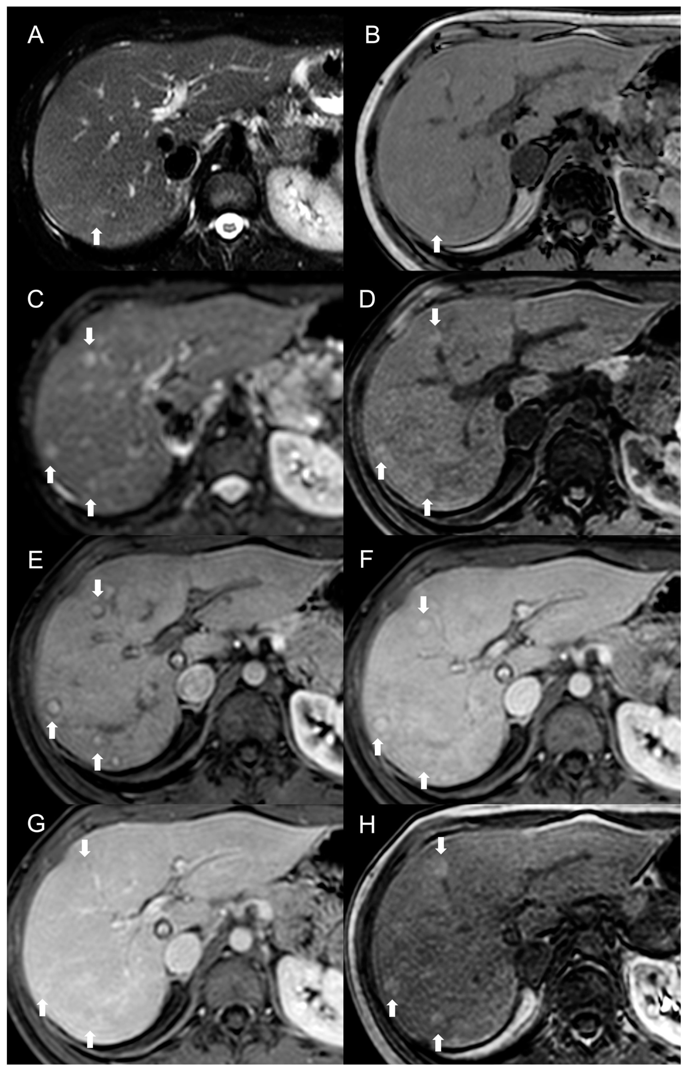 Diagnostics 13 02346 g003