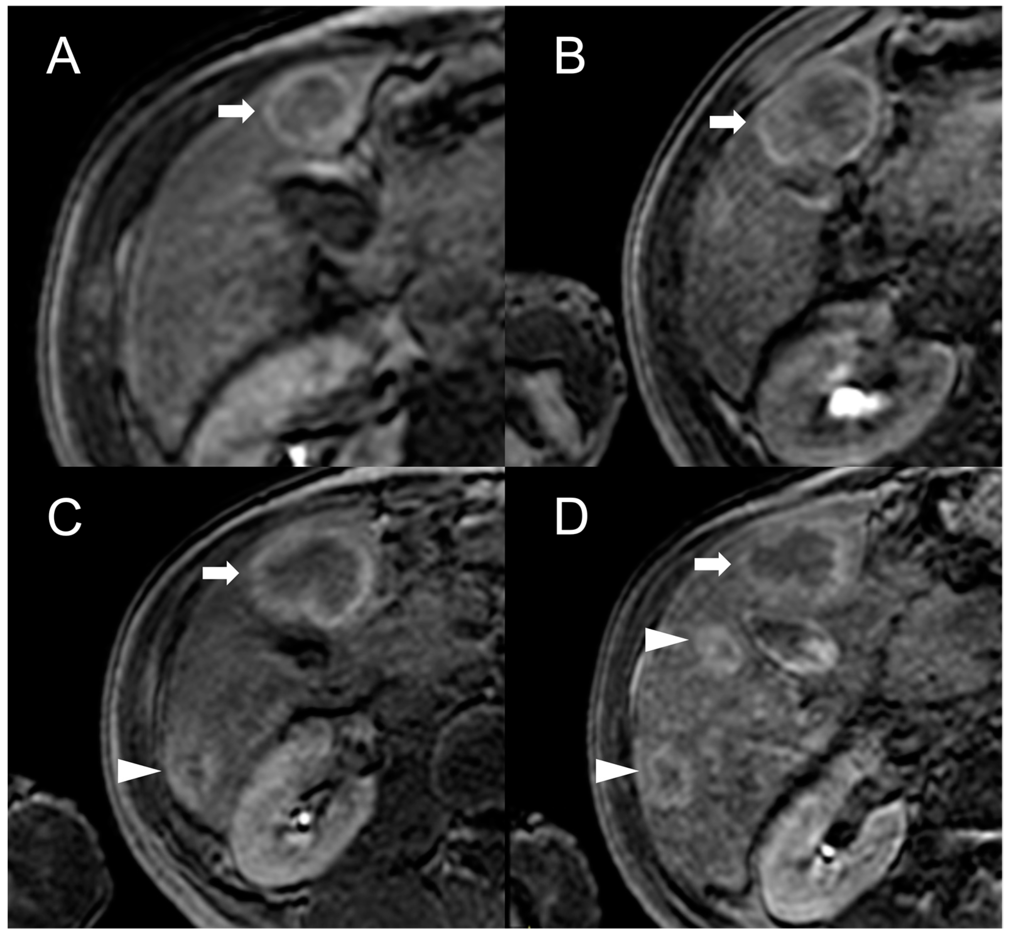 Diagnostics 13 02346 g004