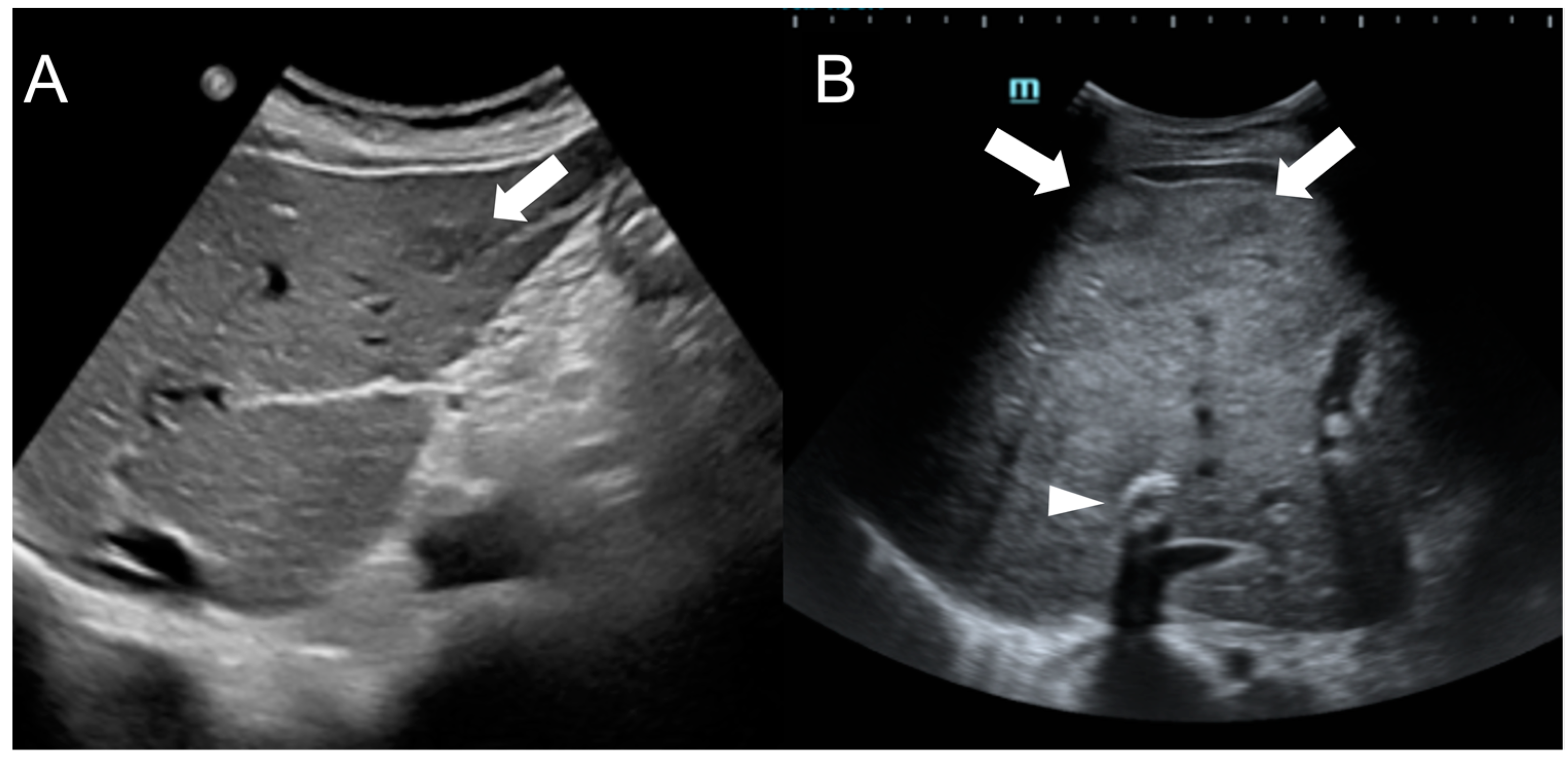 Diagnostics 13 02346 g005
