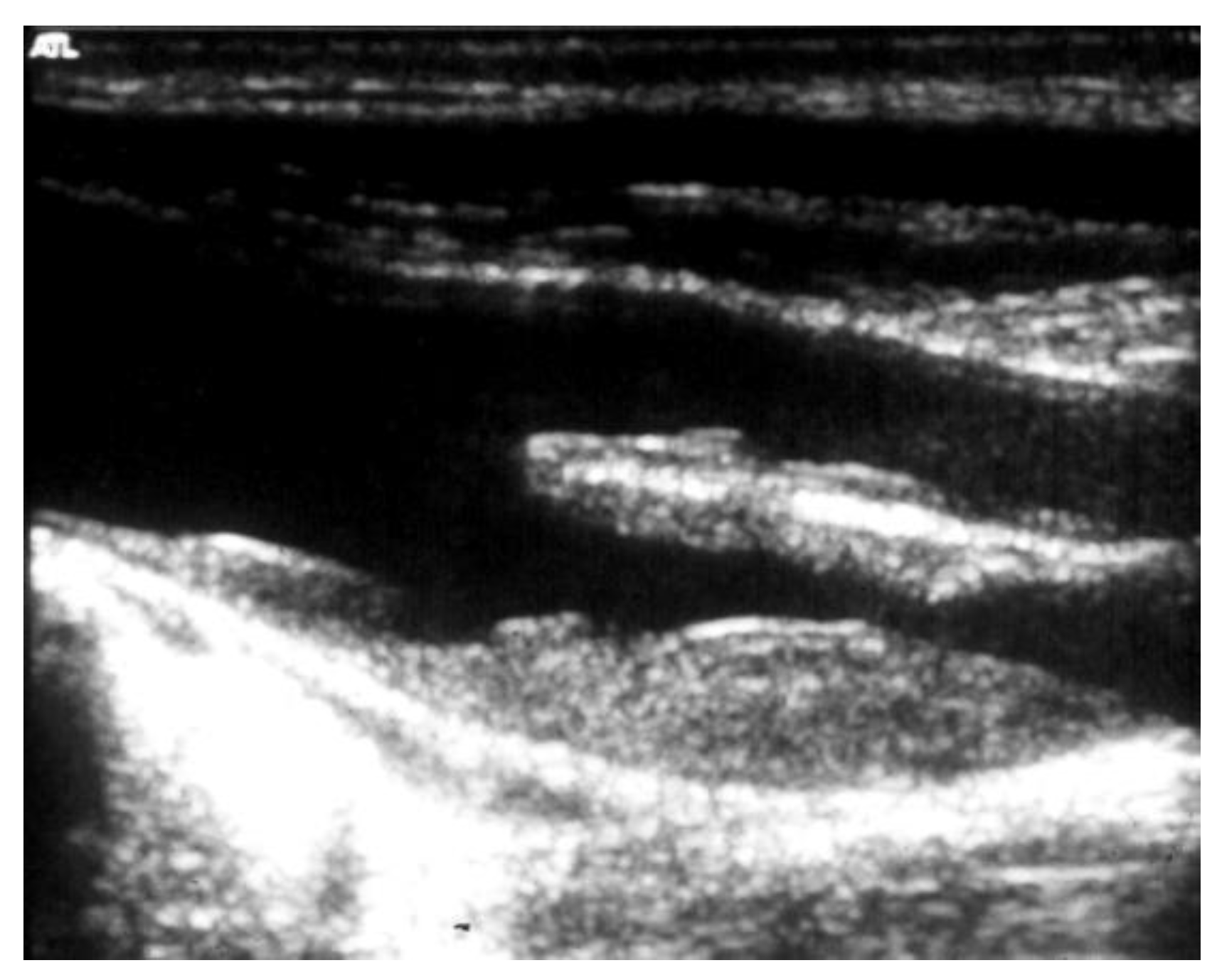 Diagnostics 13 02356 g006 Diagnostics 13 02356 g006