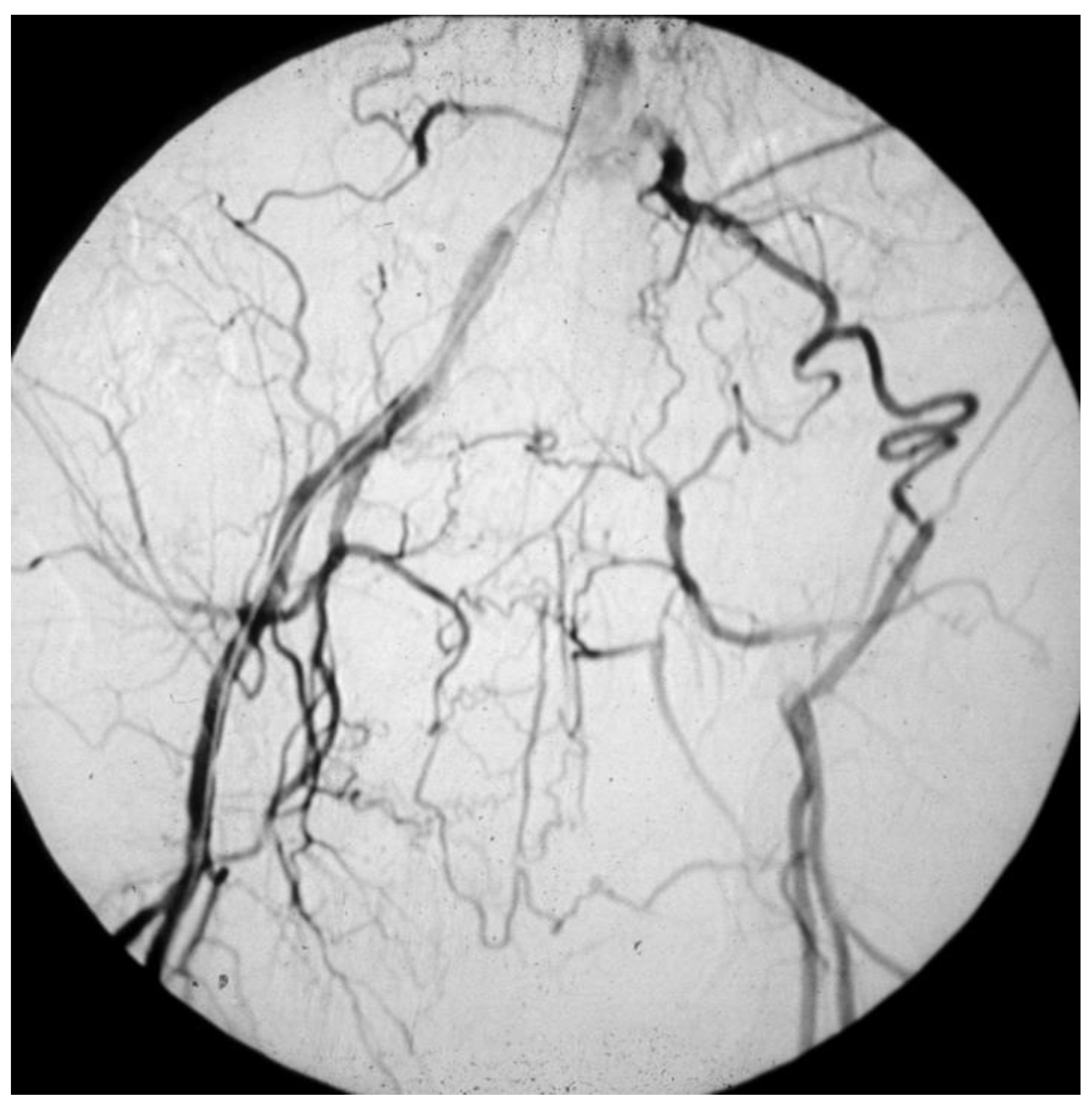 Diagnostics 13 02356 g008 Diagnostics 13 02356 g008