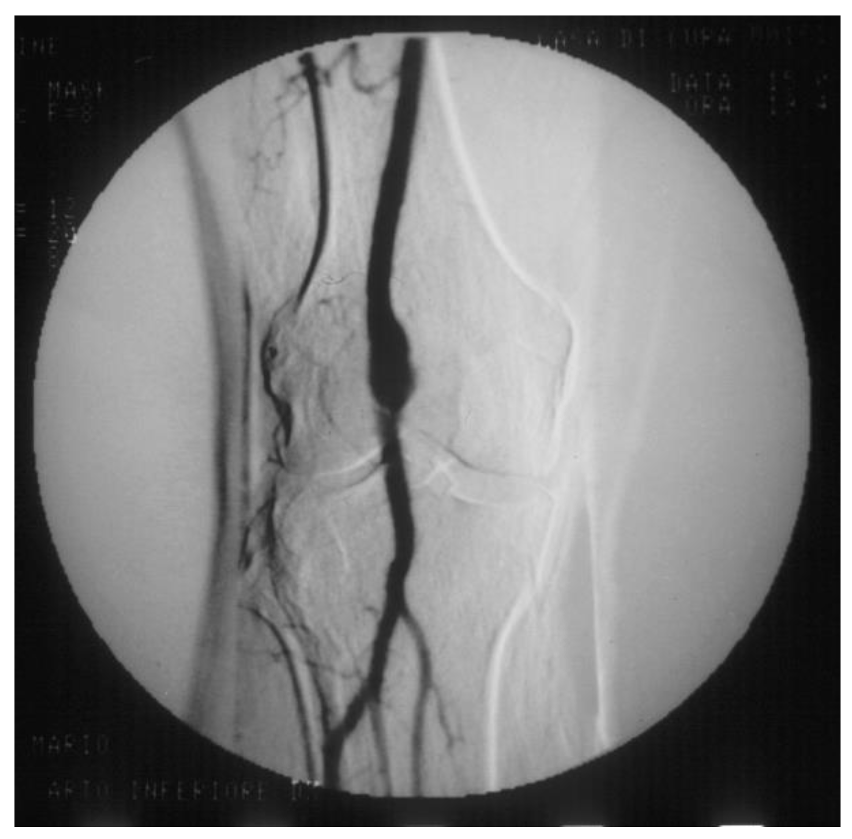 Diagnostics 13 02356 g011 Diagnostics 13 02356 g011