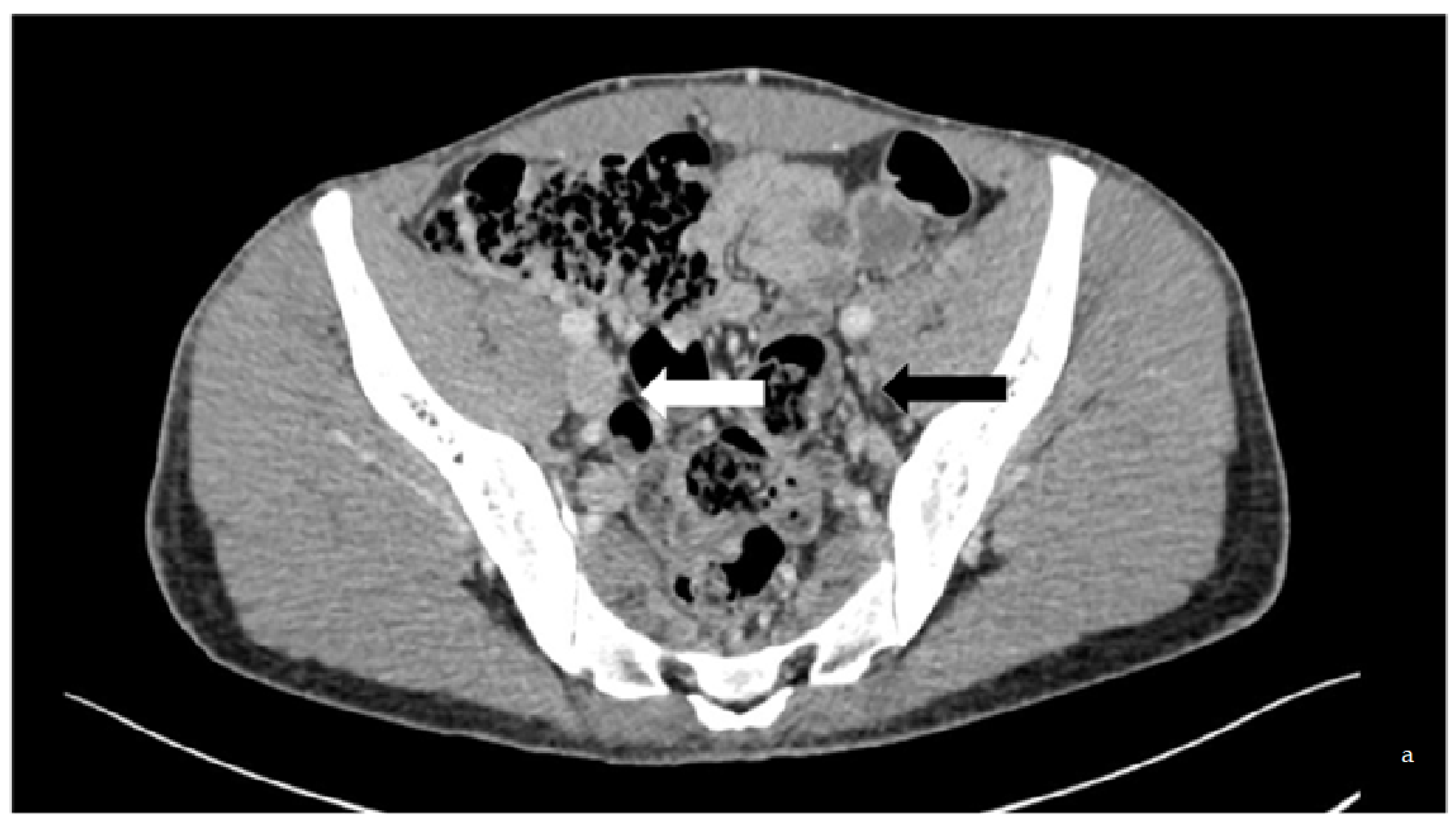 Diagnostics 13 02357 g001a