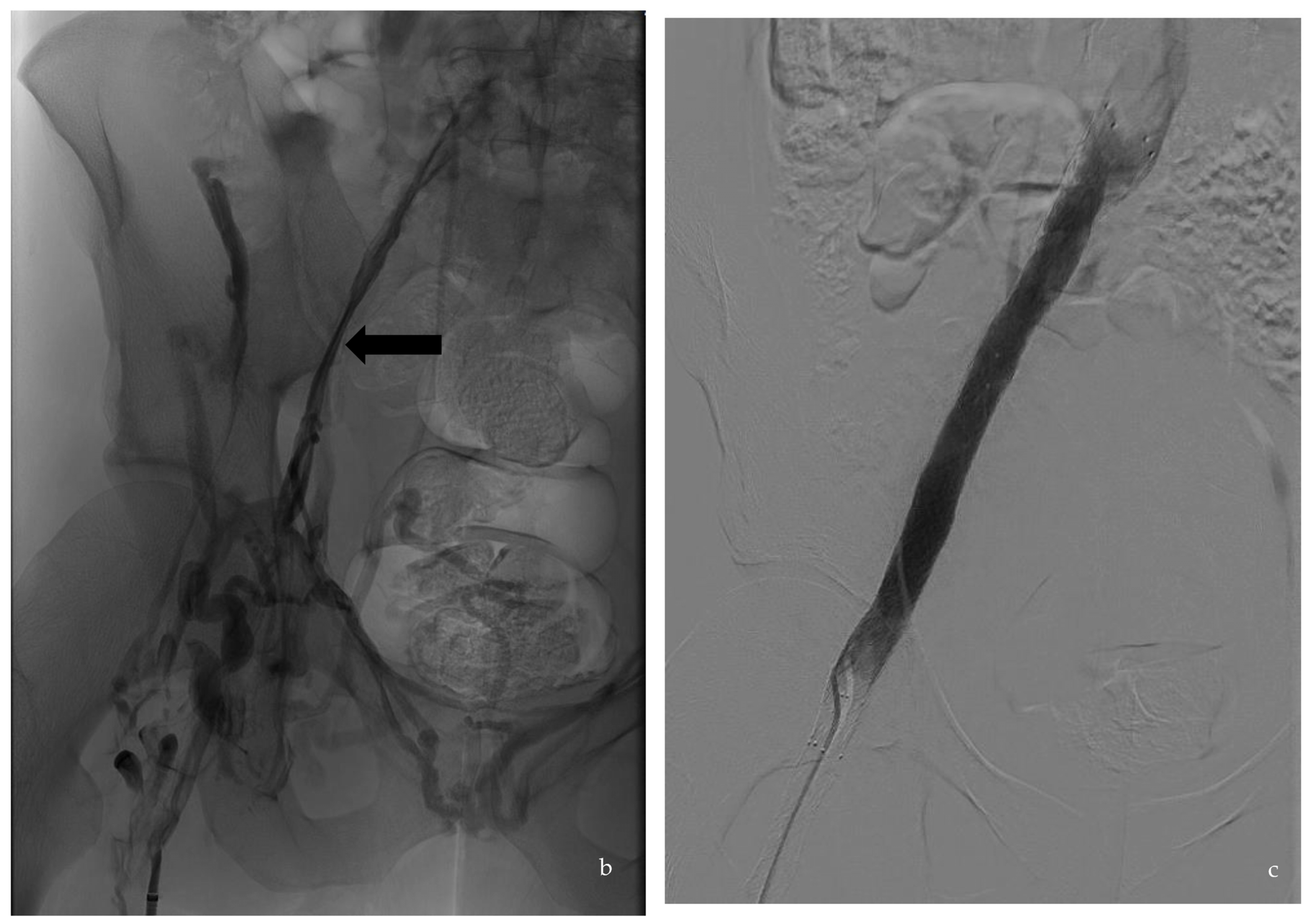 Diagnostics 13 02357 g001b