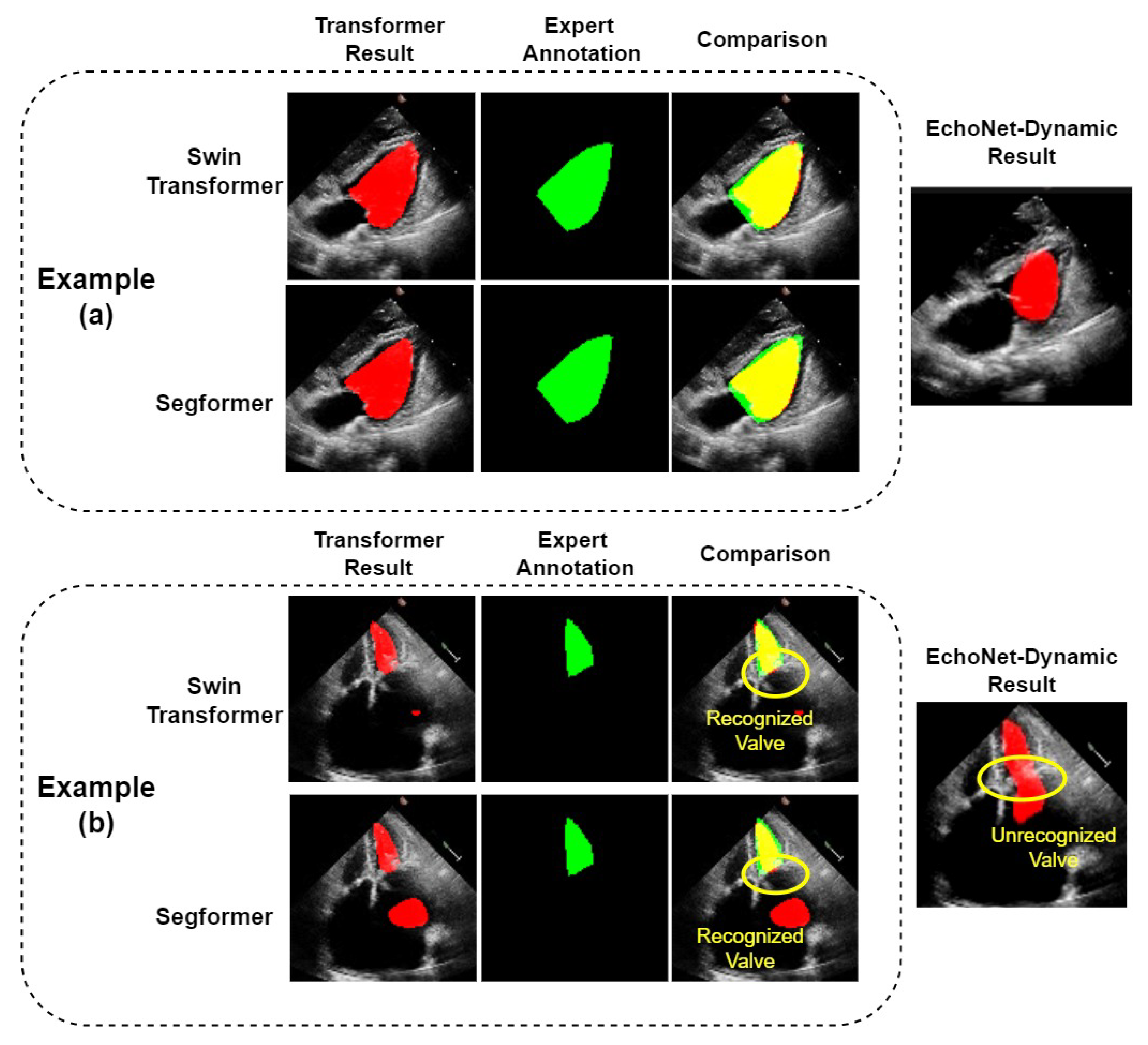 Diagnostics 13 02365 g006