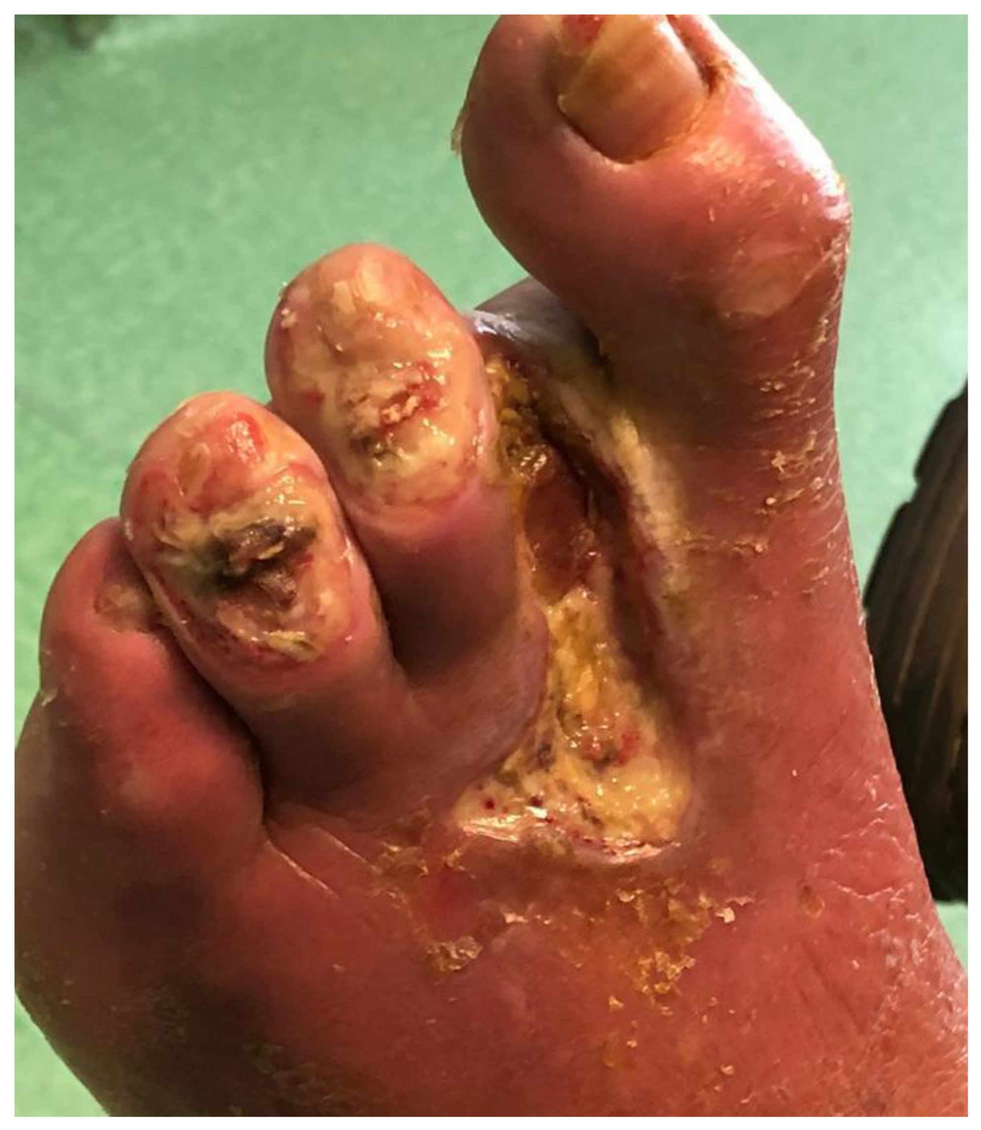 Diagnostics 13 02366 g004