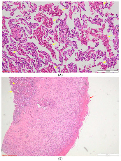 Diagnostics 13 02367 g003