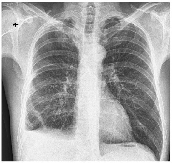 Diagnostics 13 02367 g004