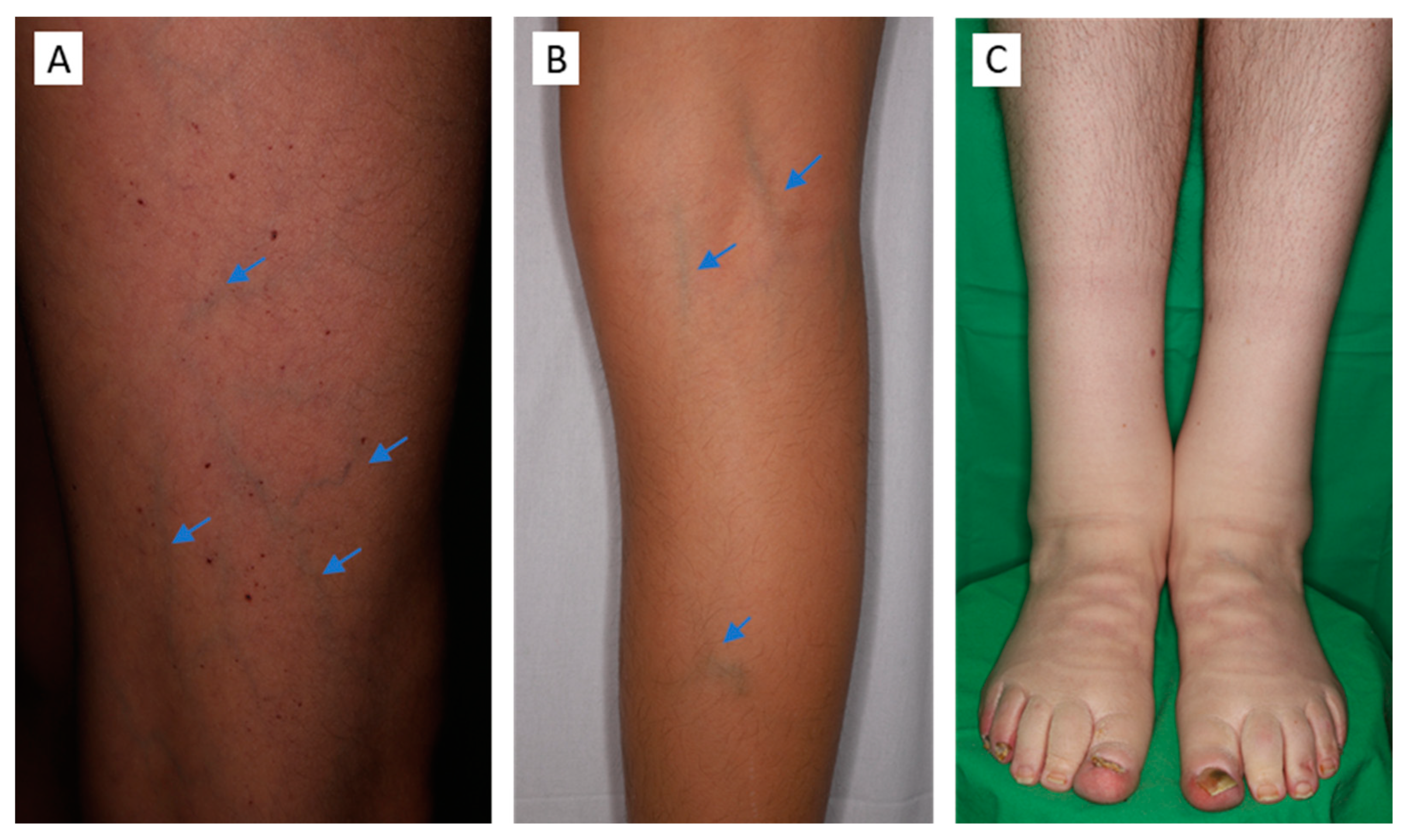 Diagnostics 13 02368 g004