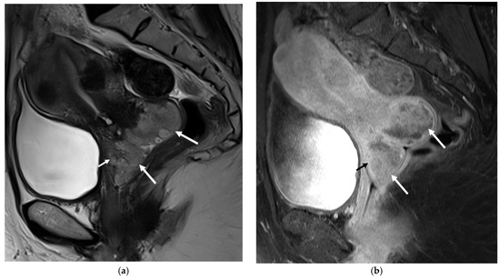 Diagnostics 13 02370 g001