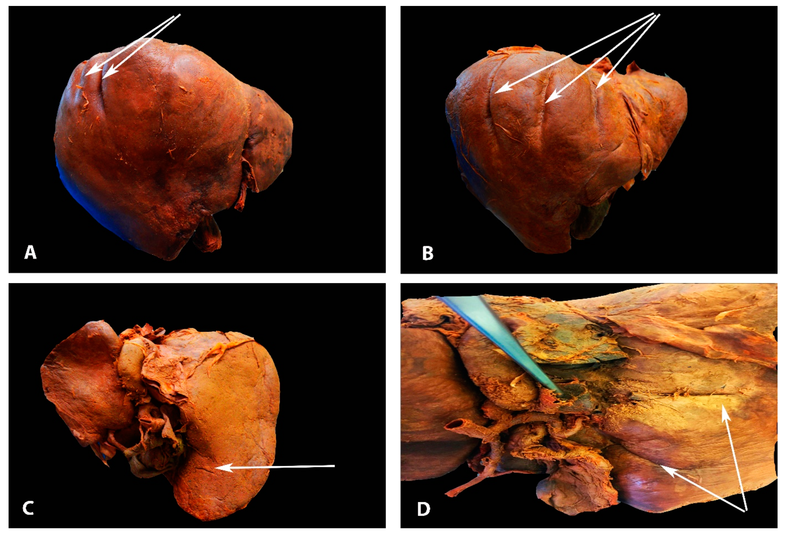 Diagnostics 13 02371 g003