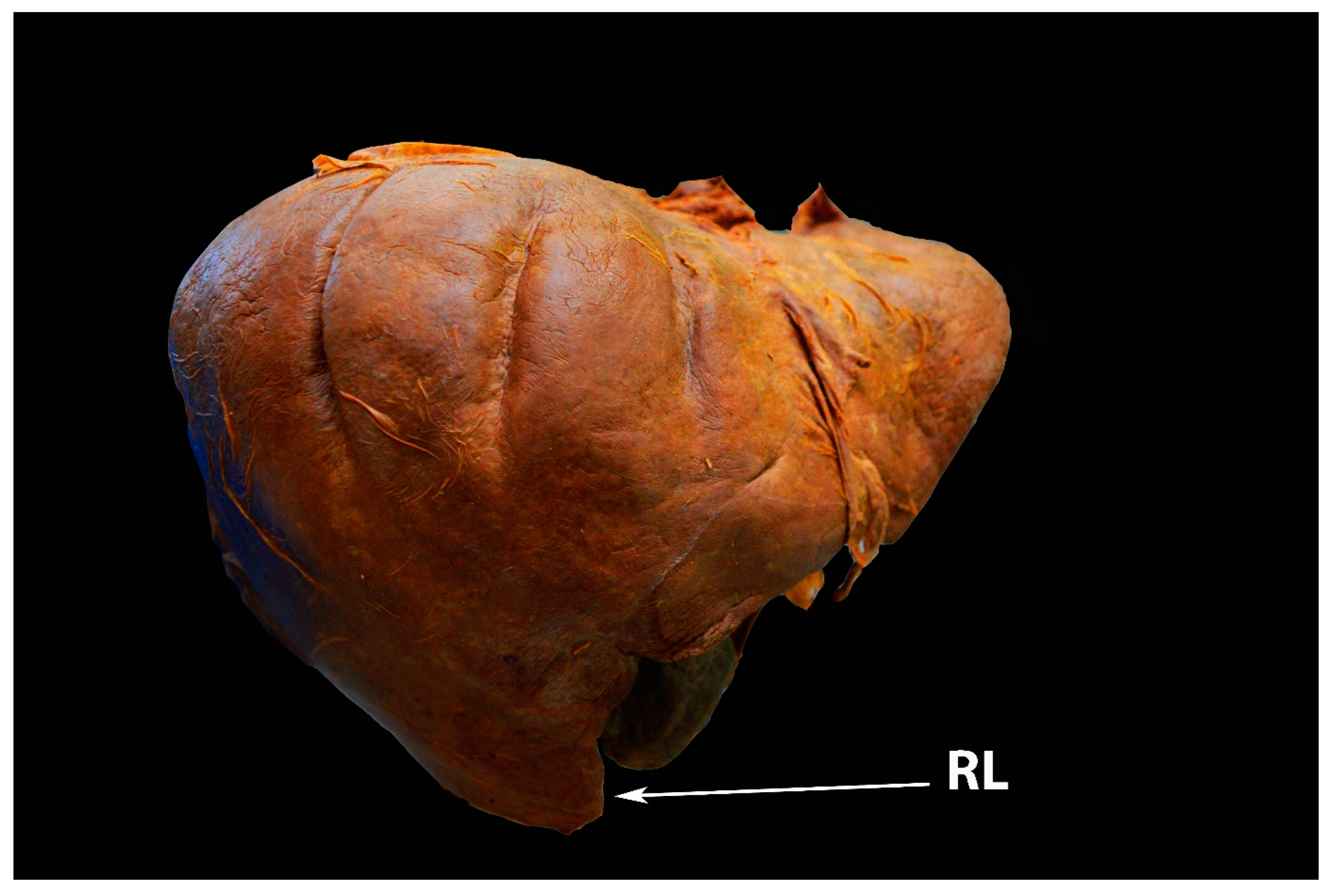 Diagnostics 13 02371 g004