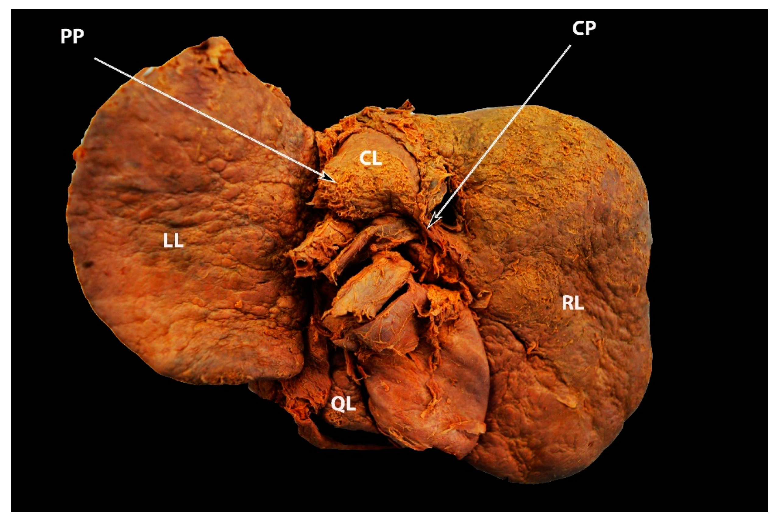 Diagnostics 13 02371 g006