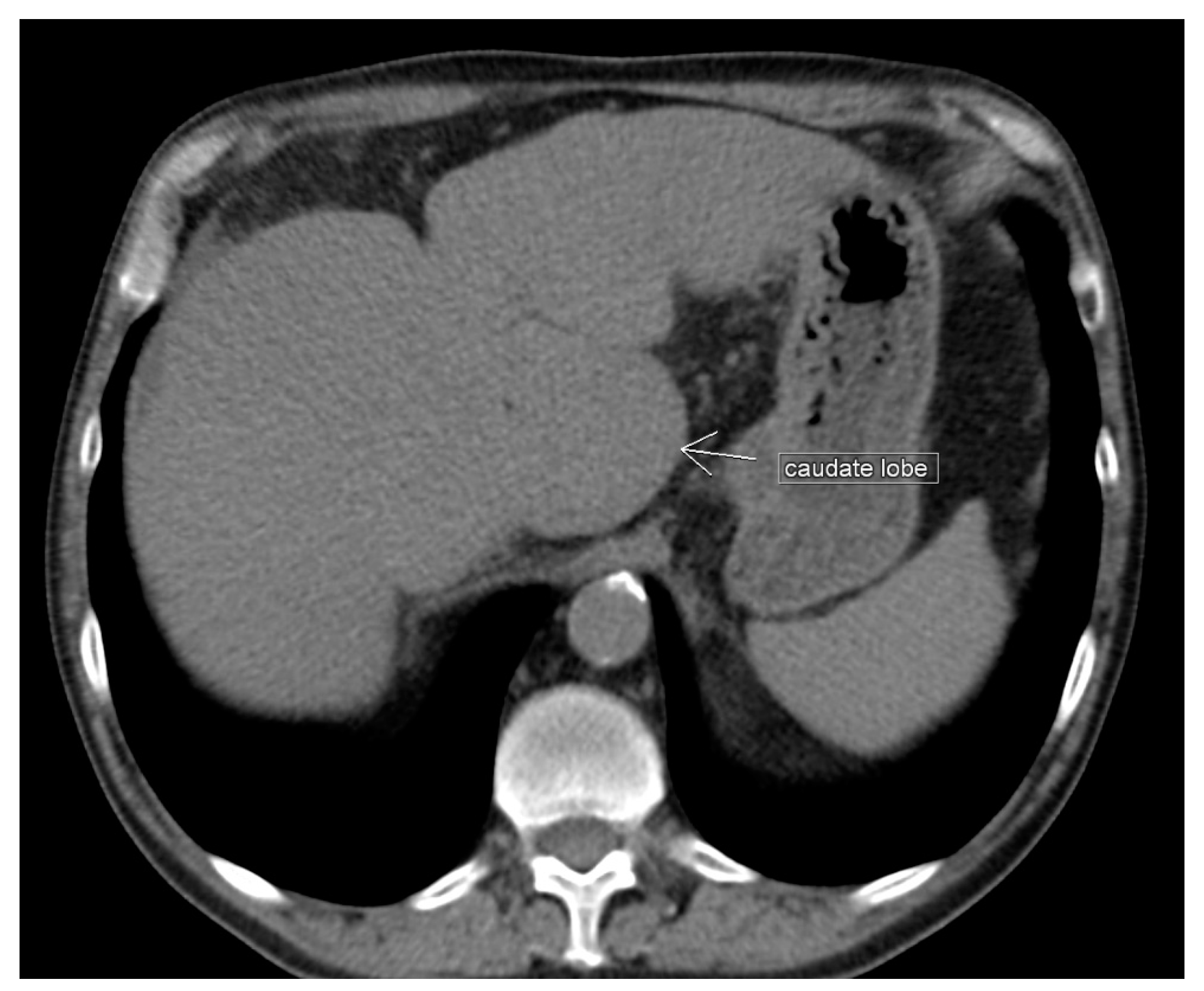 Diagnostics 13 02371 g007