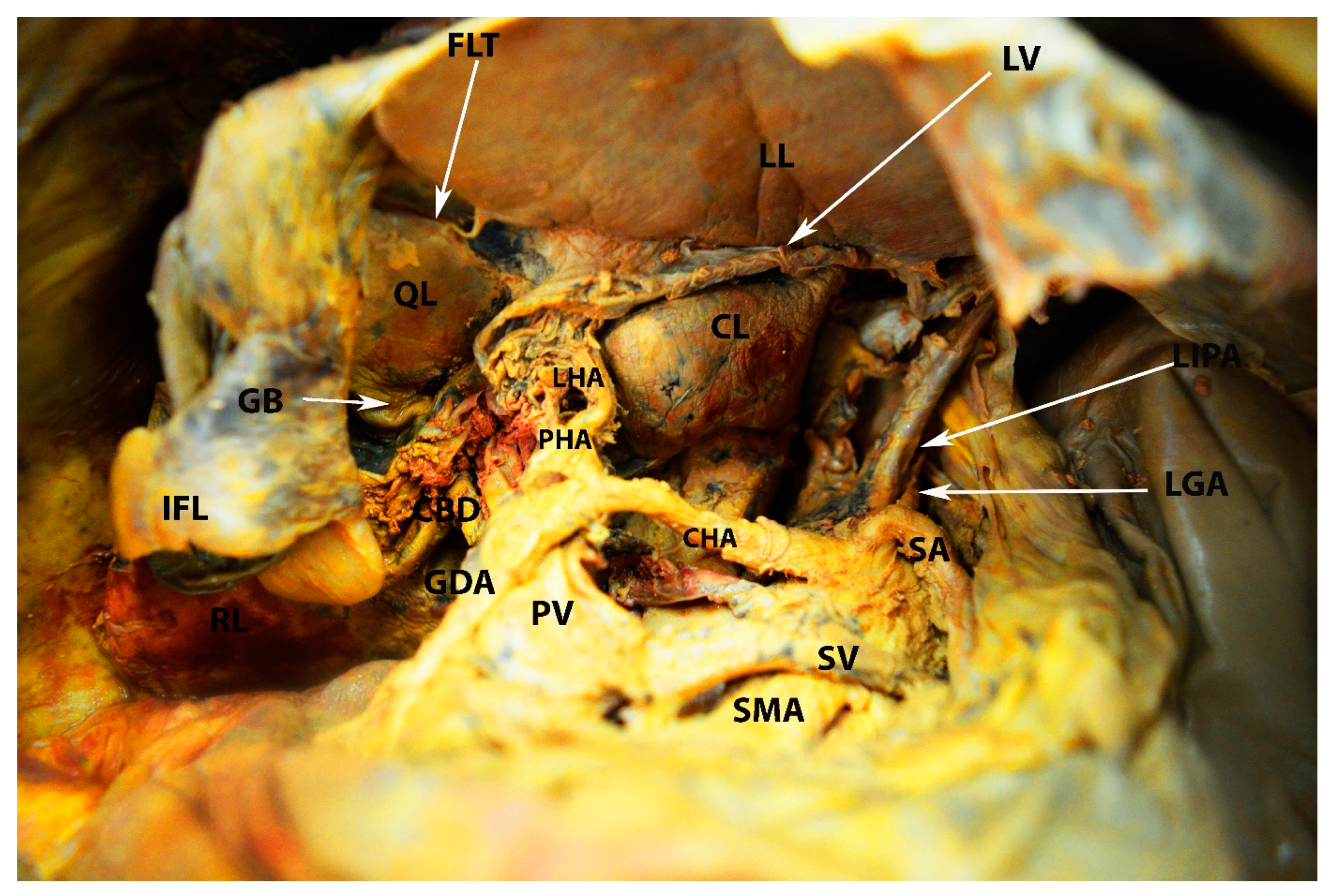 Diagnostics 13 02371 g012