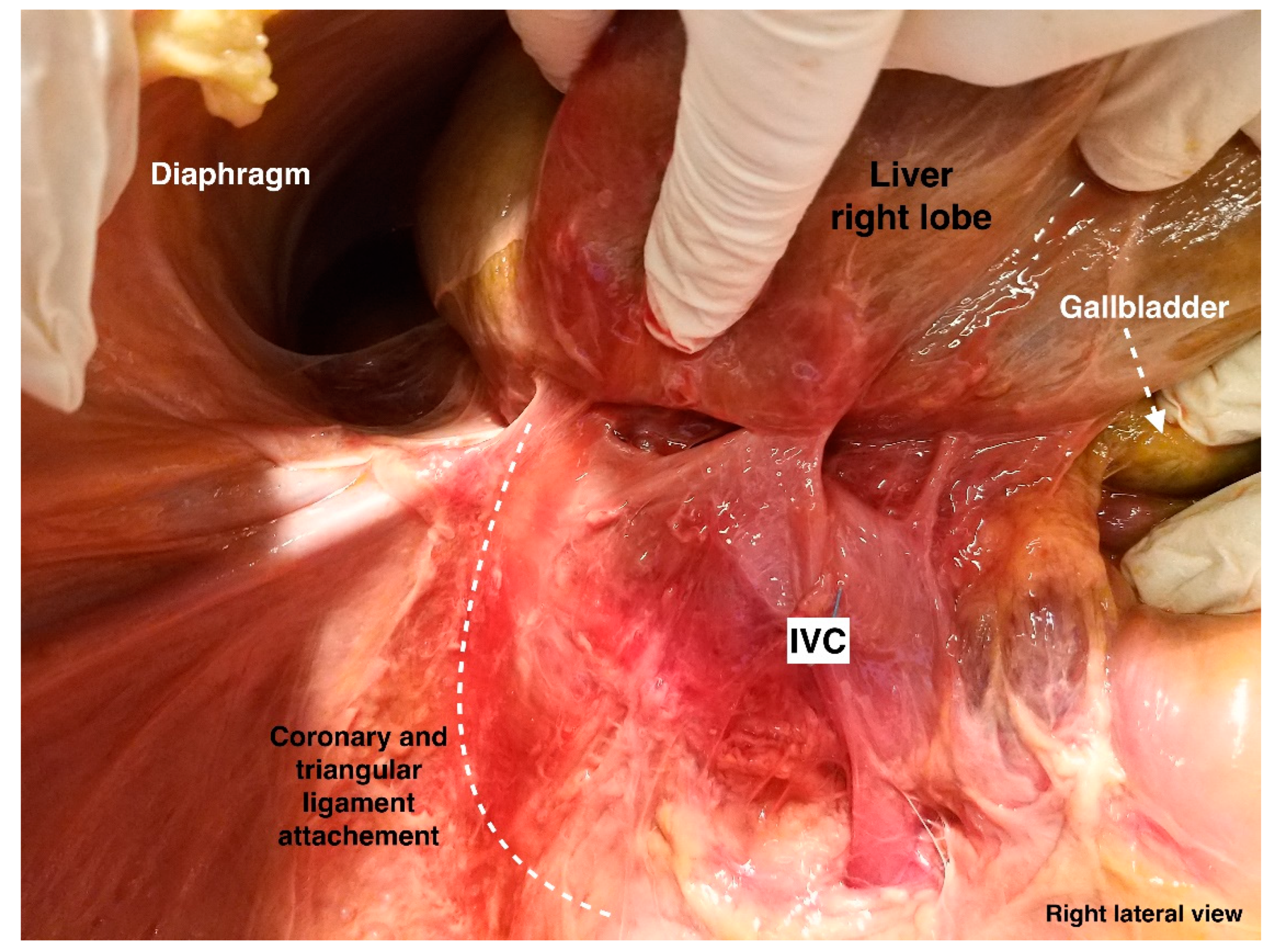 Diagnostics 13 02371 g013
