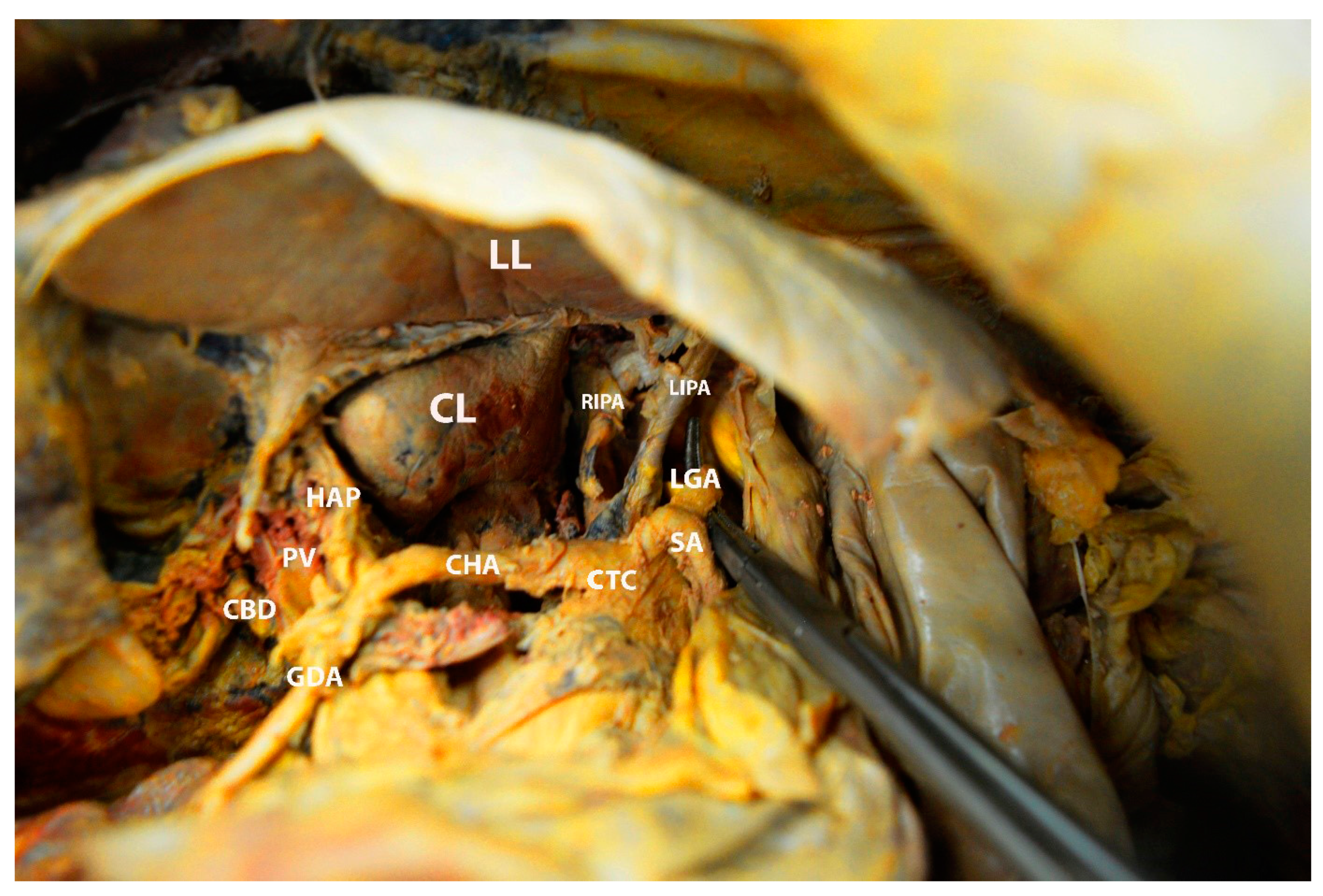 Diagnostics 13 02371 g016