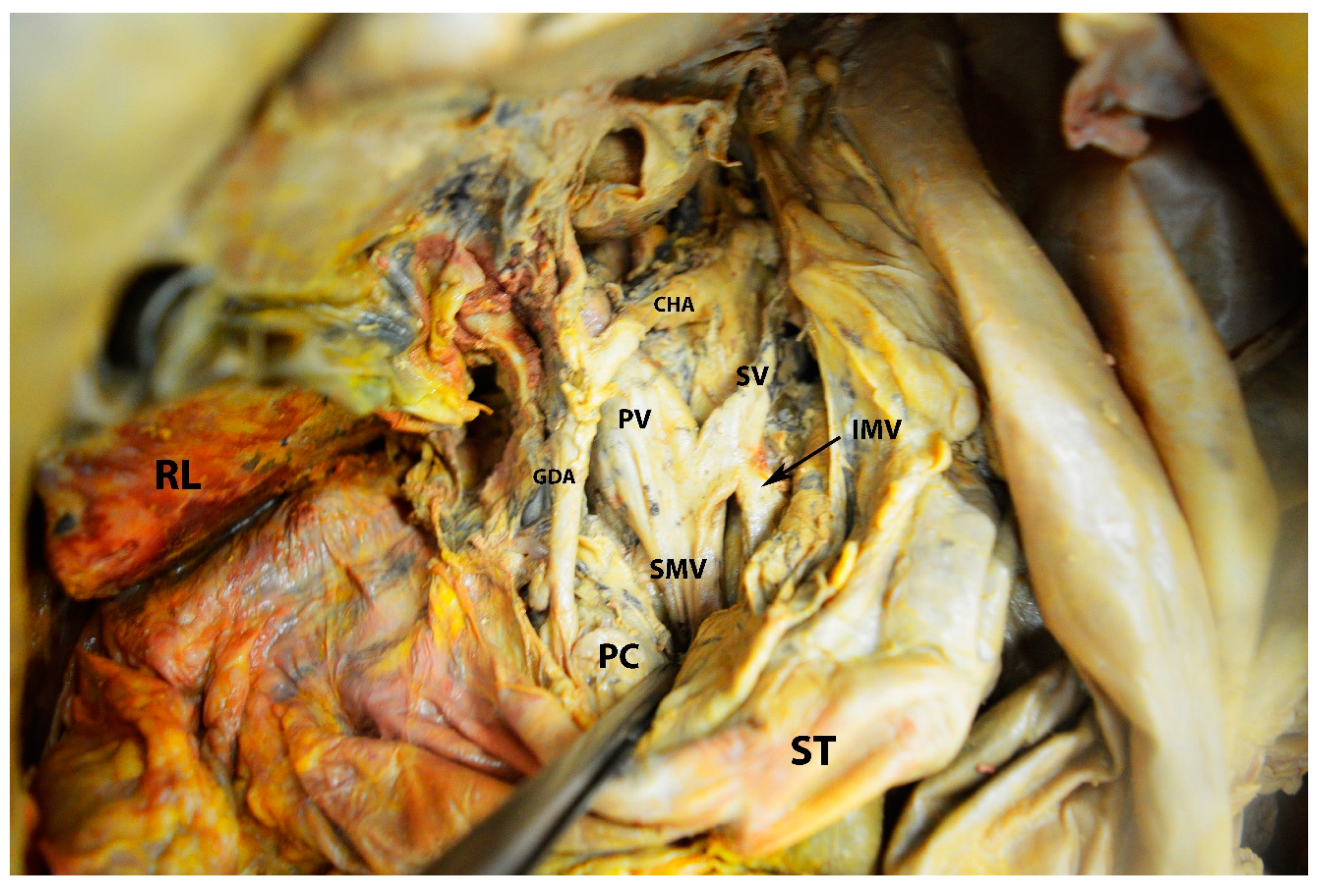 Diagnostics 13 02371 g017