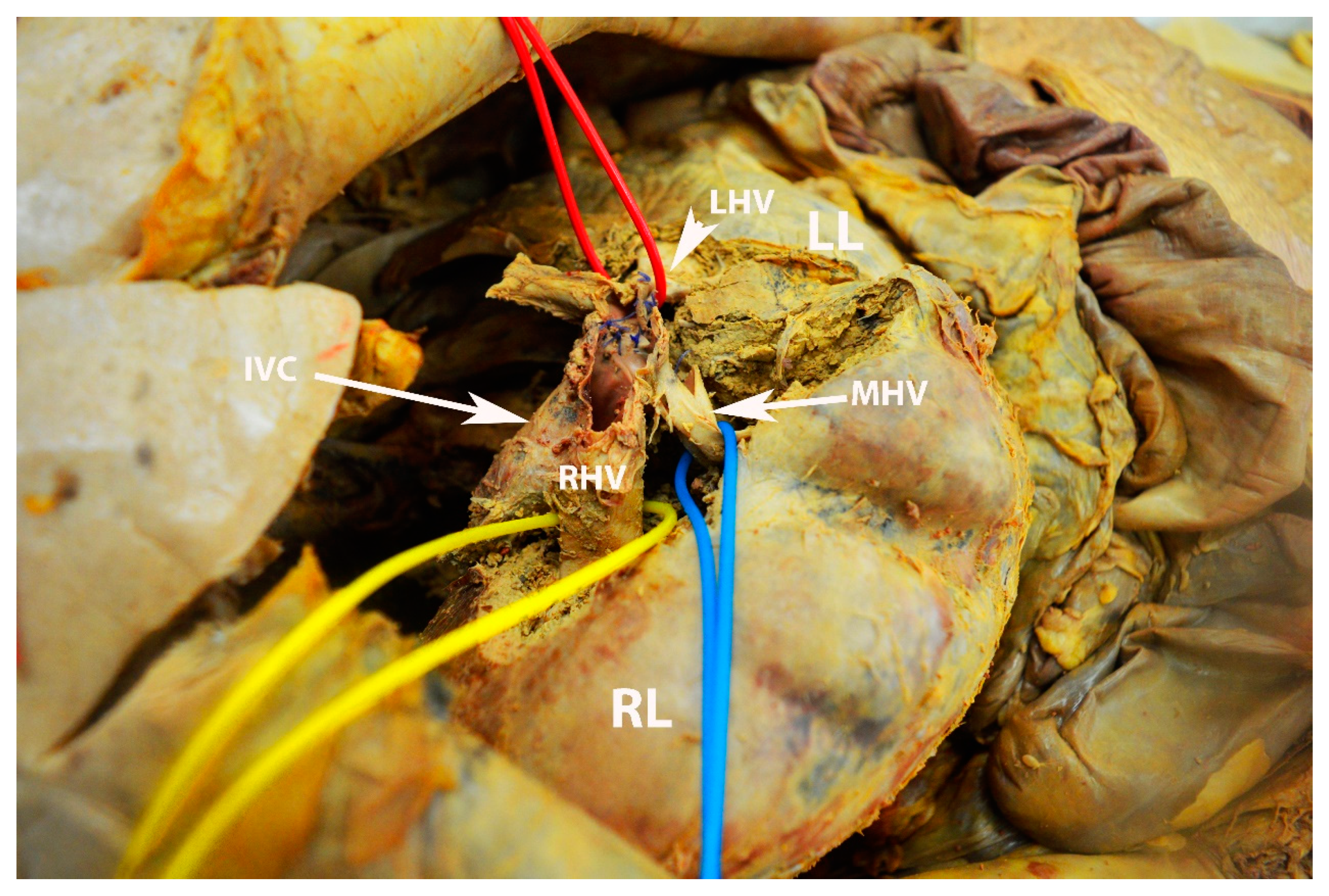 Diagnostics 13 02371 g018