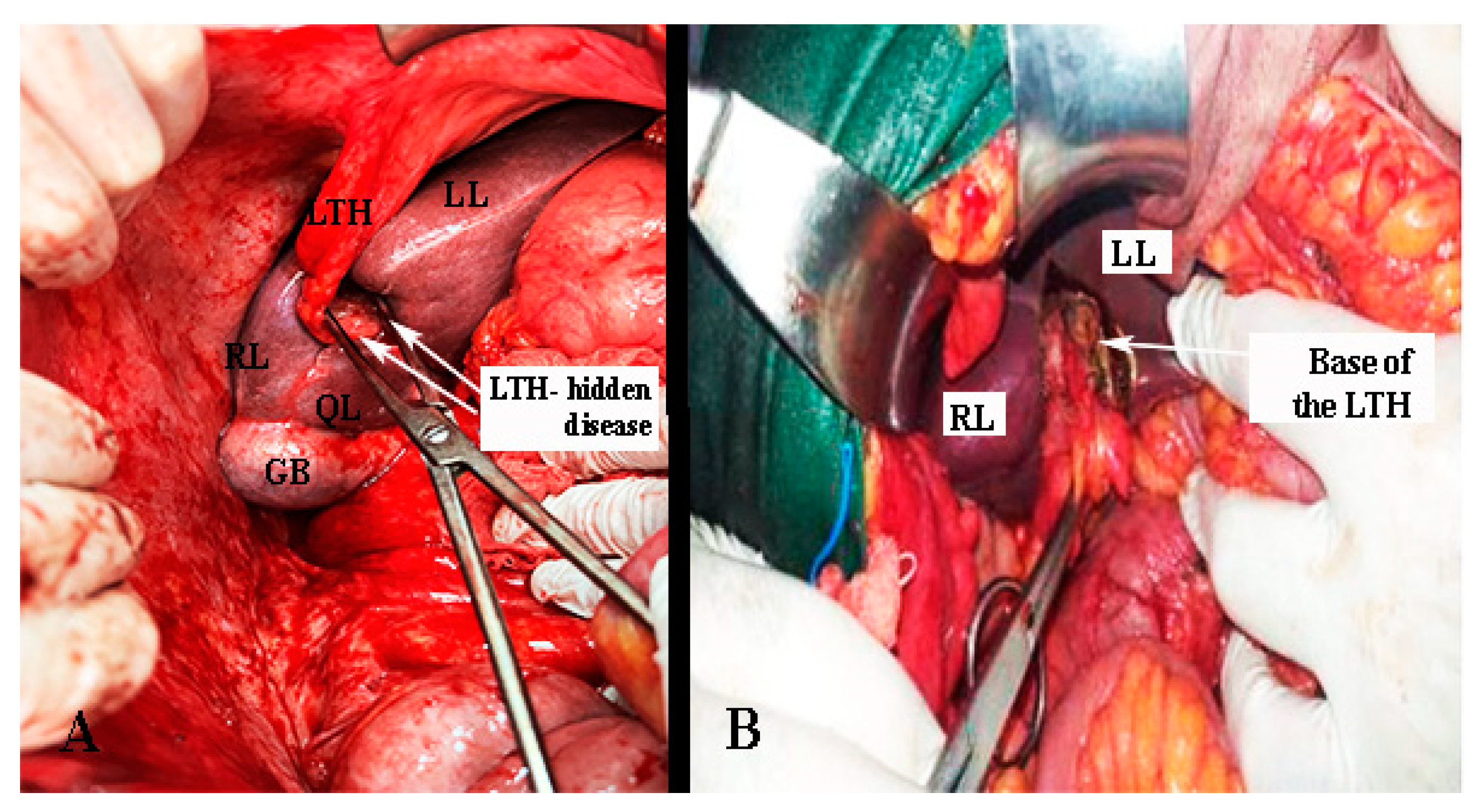 Diagnostics 13 02371 g023