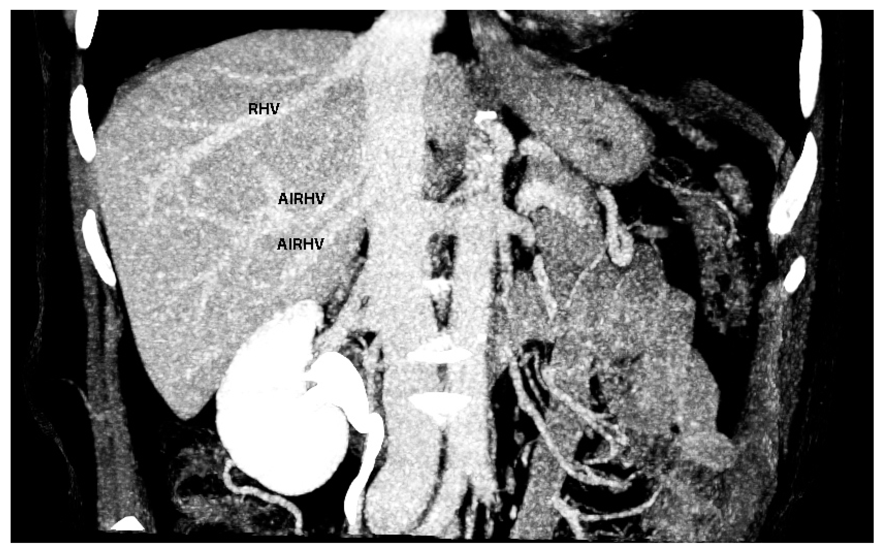 Diagnostics 13 02371 g024
