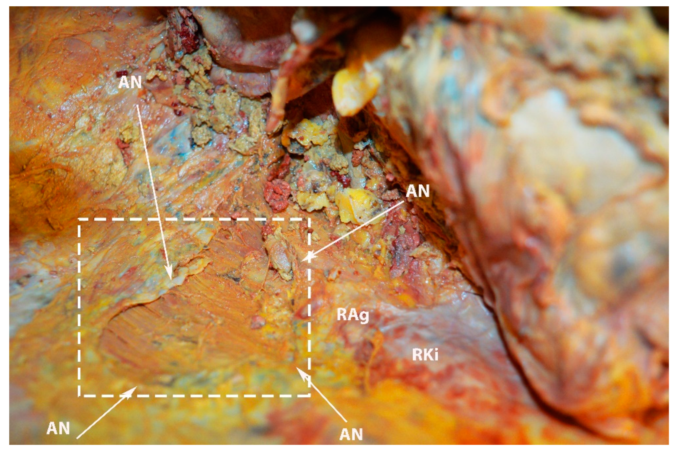 Diagnostics 13 02371 g025